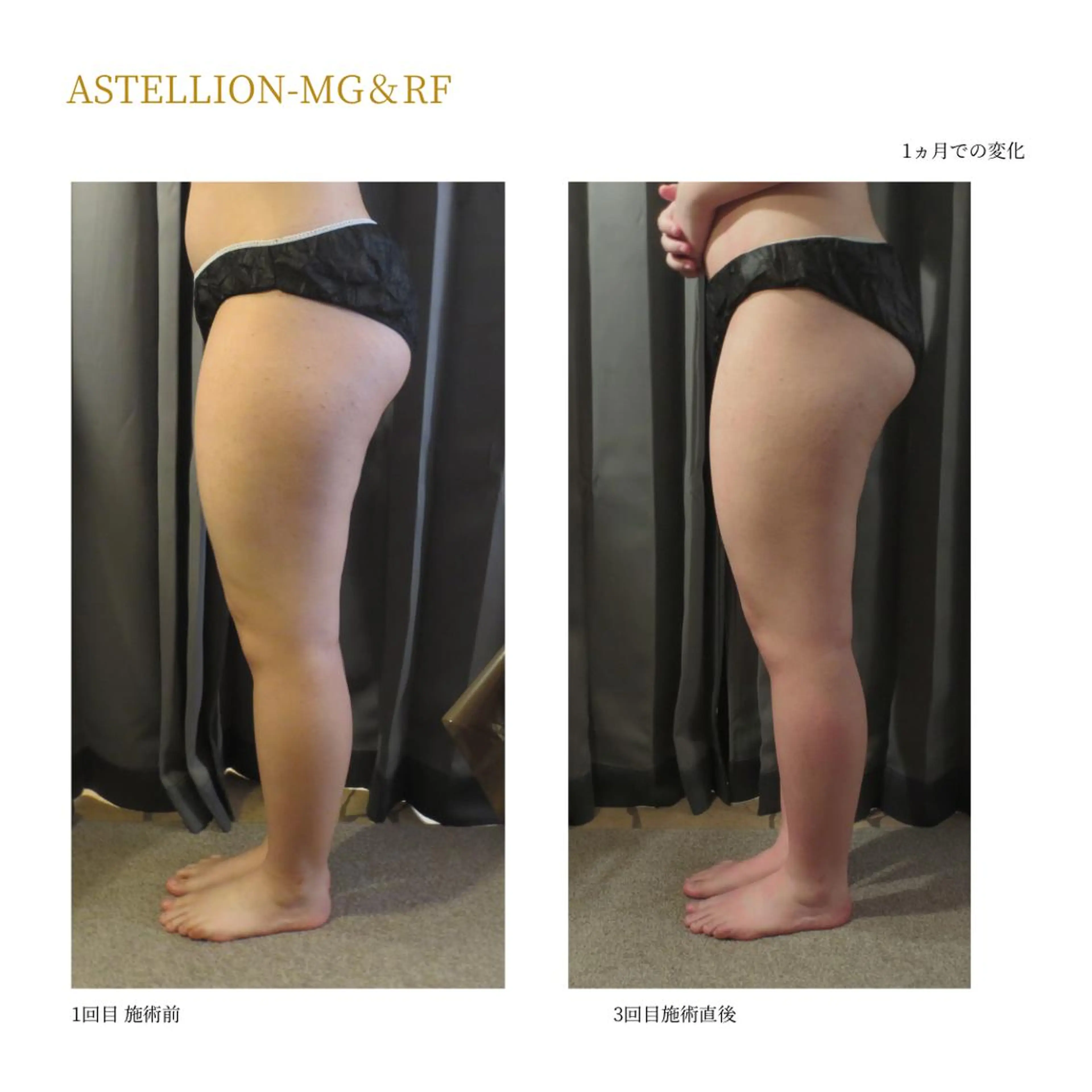 Sylphya (シルフィア)のエステ・リラクイメージ