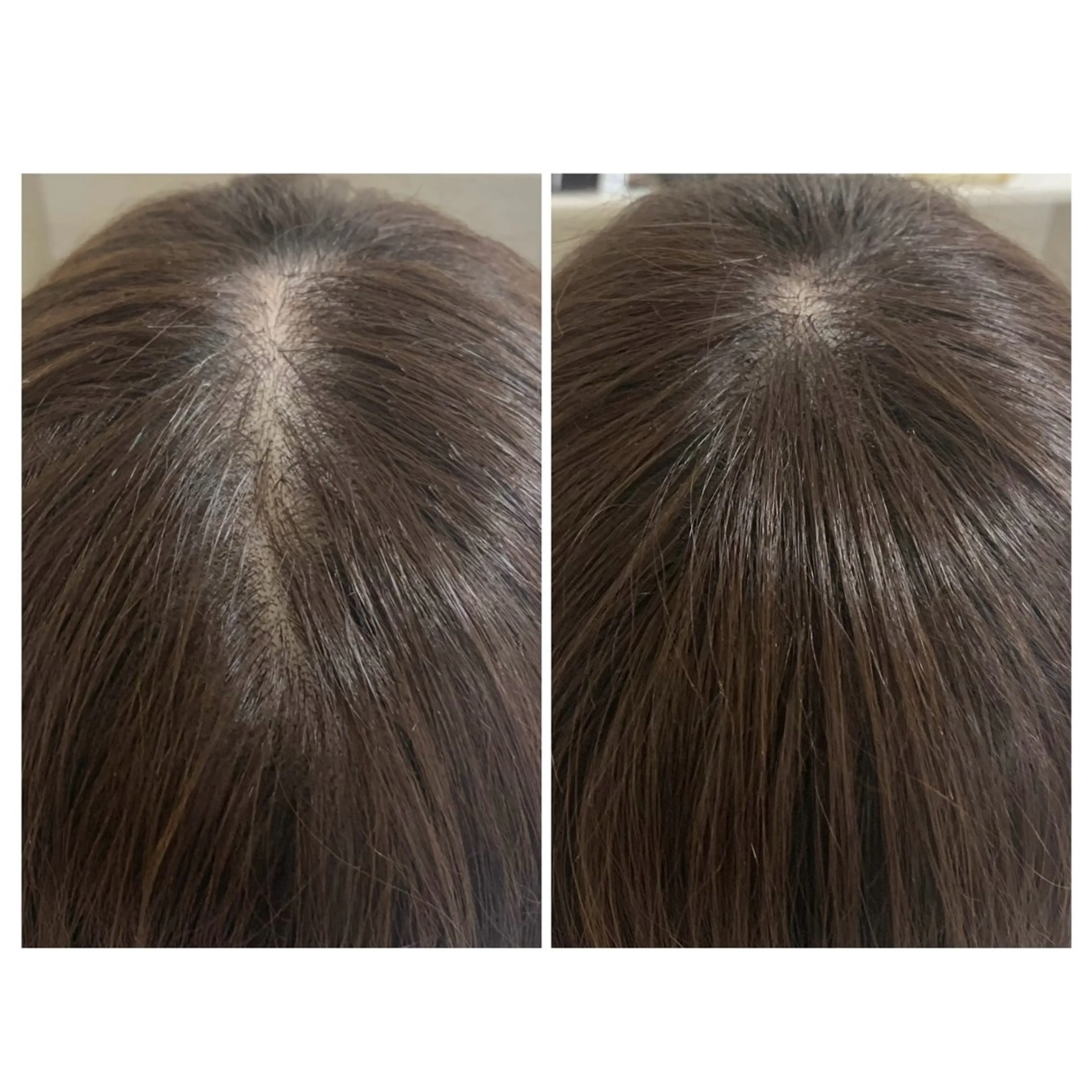 【増毛エクステ】2,000本✨️ 自然にバレずにボリュームUP❗️ ミニモ限定価格 20%OFF🕊‪の写真