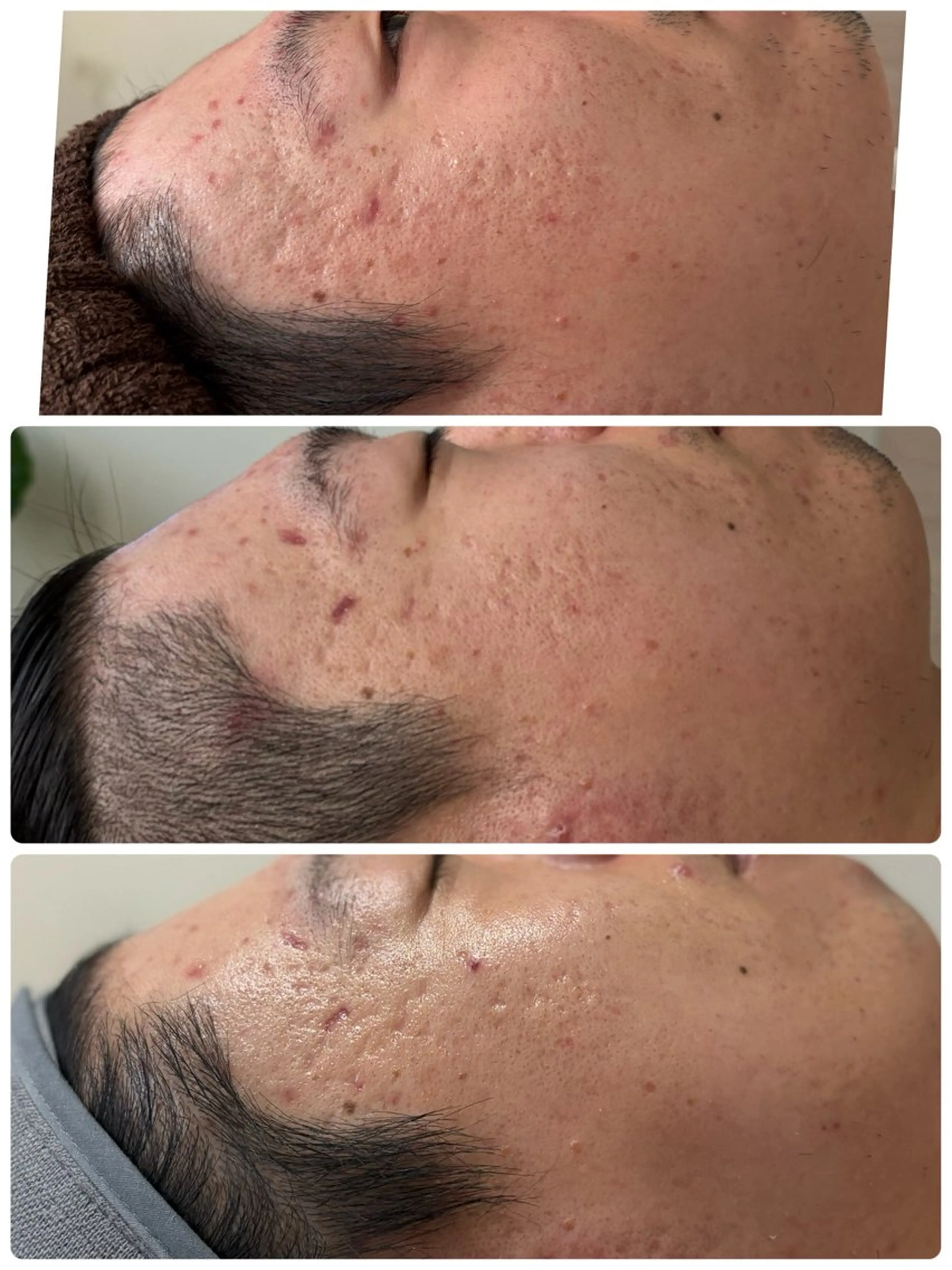 エステ ロミロミ ・艶肌小顔 RIEのエステ・リラクイメージ