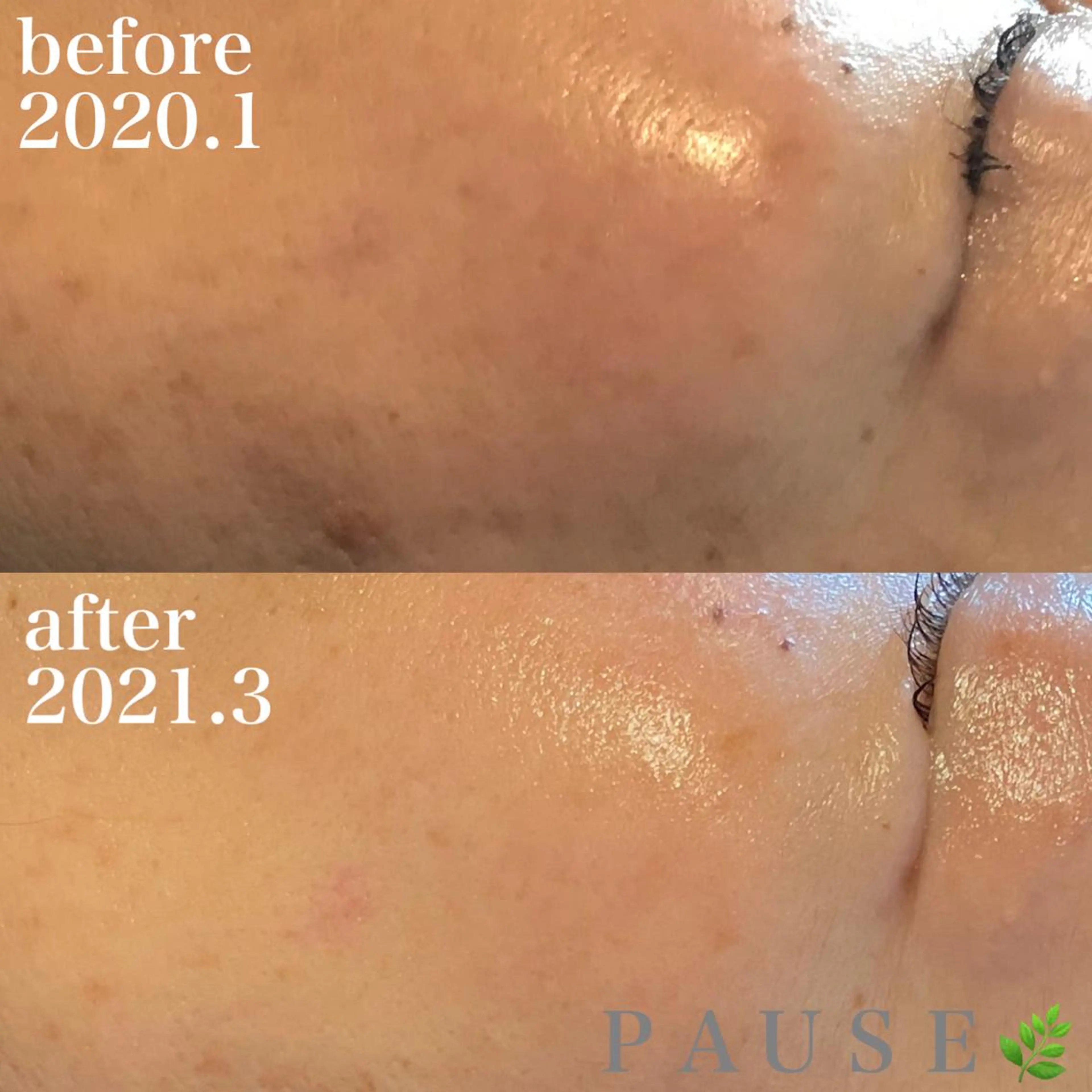 エステ リラク 浜野 恵美のエステ・リラクイメージ