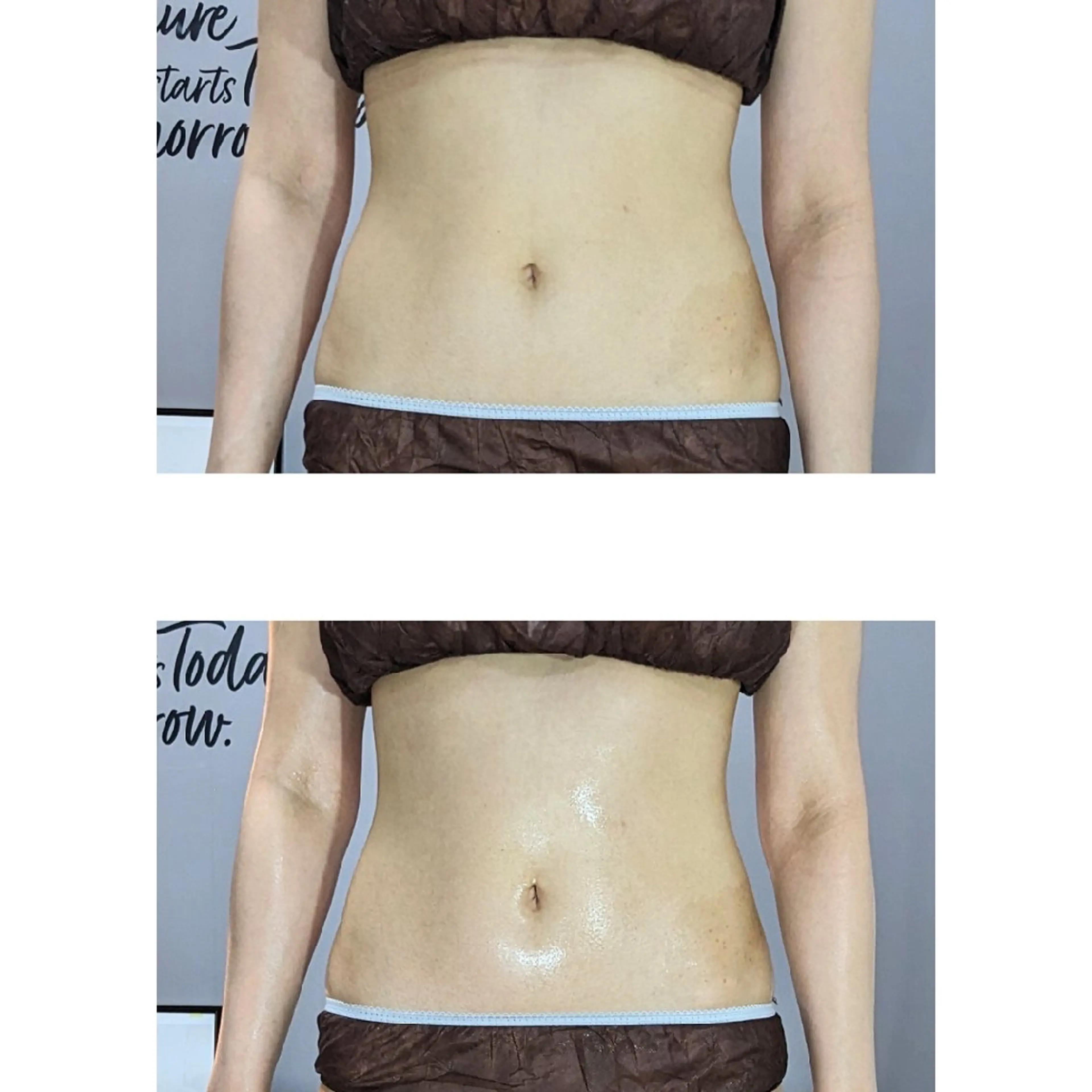 プライベートサロンBRAG所属・プライベートサロン BRAG🏠男女OKのエステ・リラクイメージ