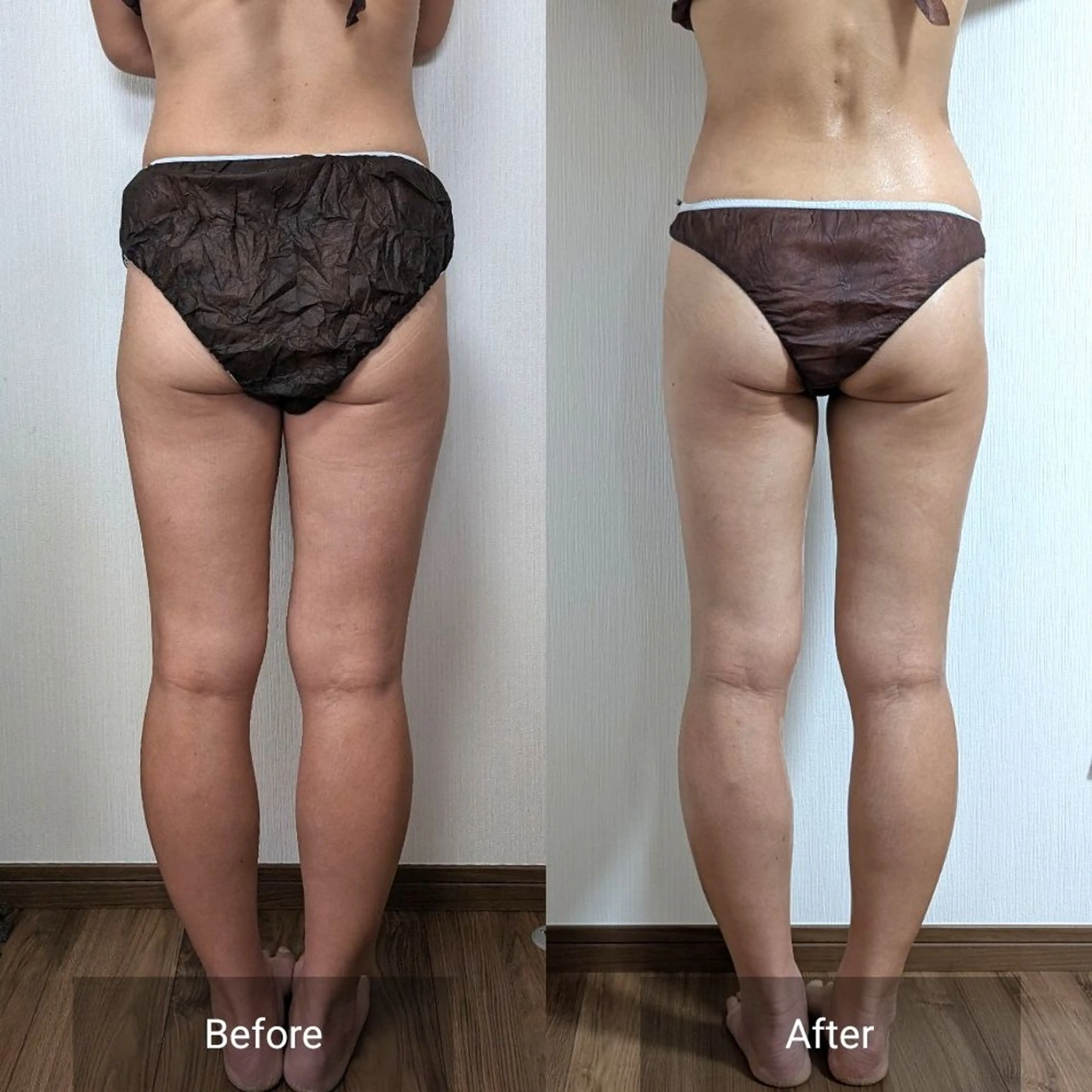 エステ nail RiRi アトレナチュラのエステ・リラクイメージ