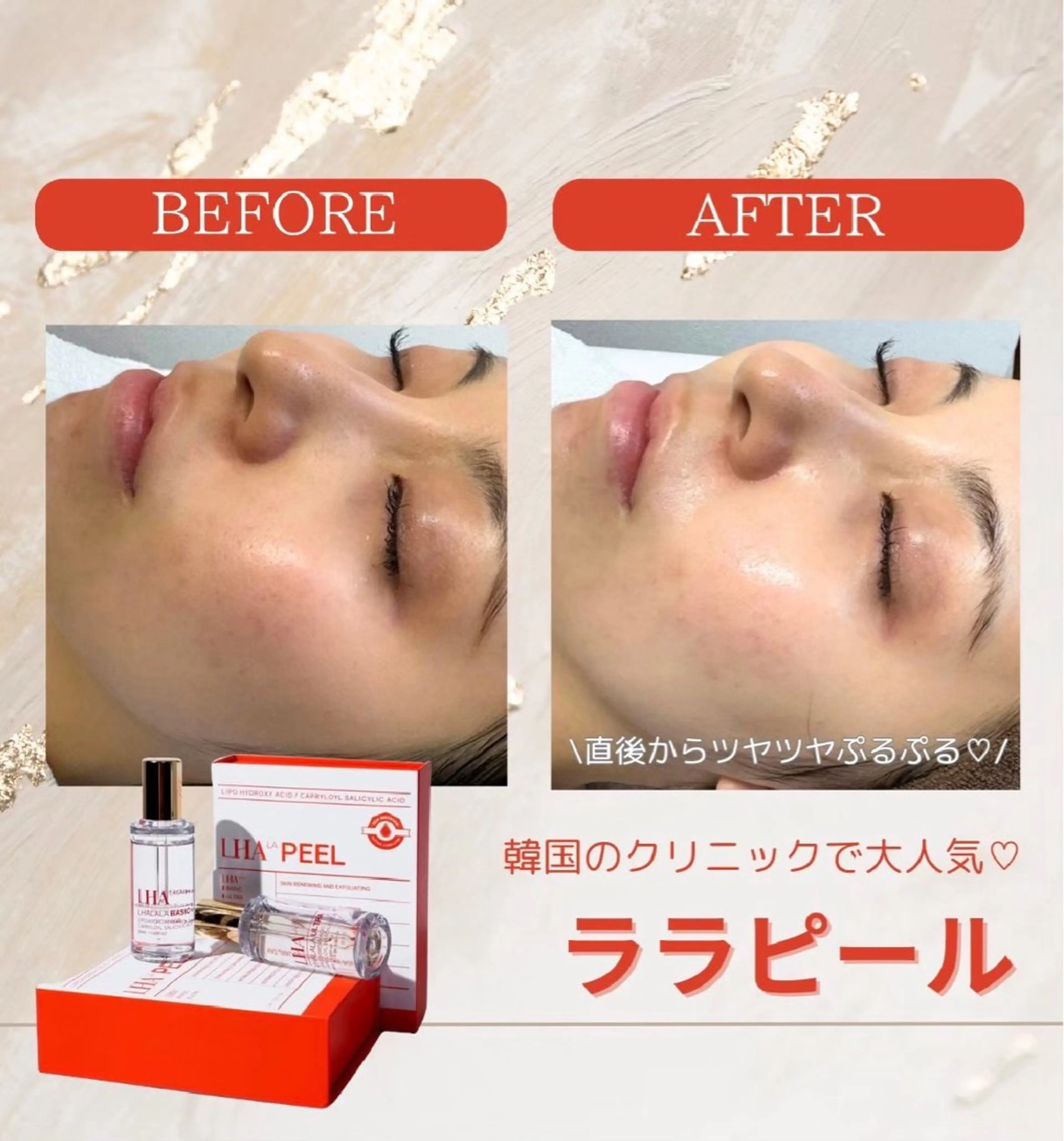 【地域最安値】脱毛/ フェイシャル　山下のエステ・リラクイメージ