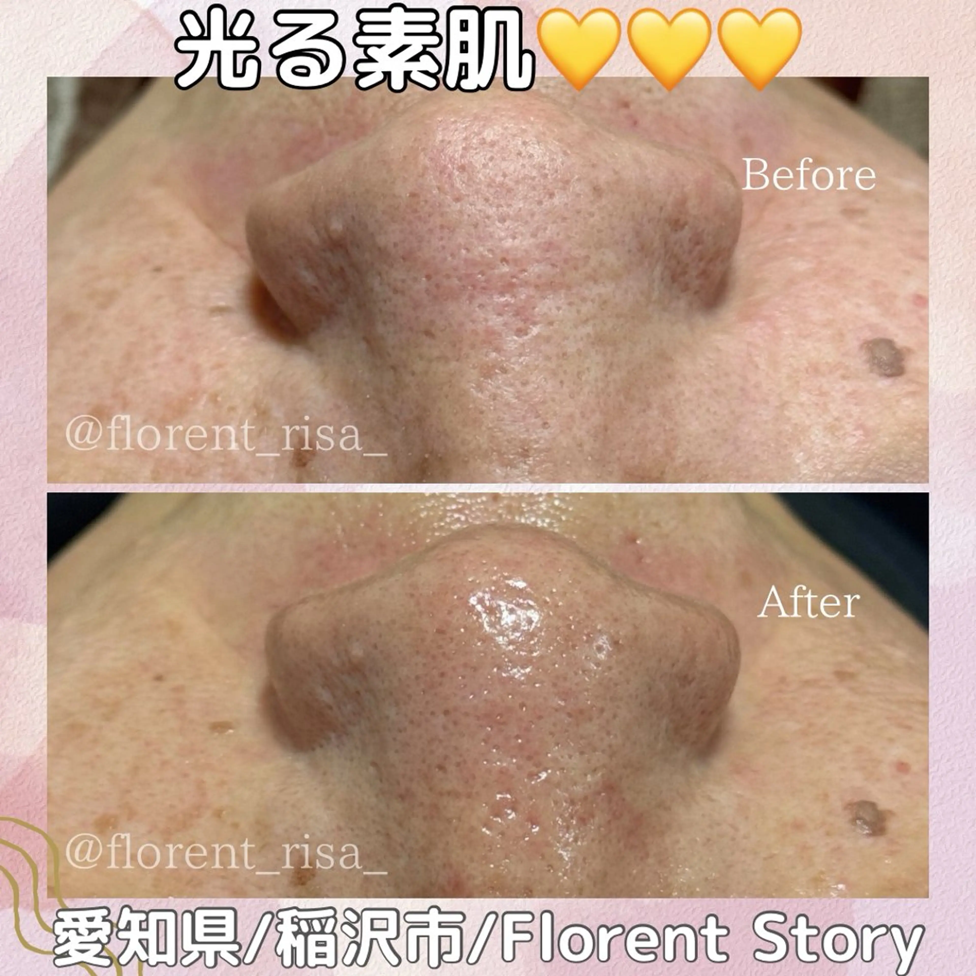 エステ 田中 里沙のエステ・リラクイメージ