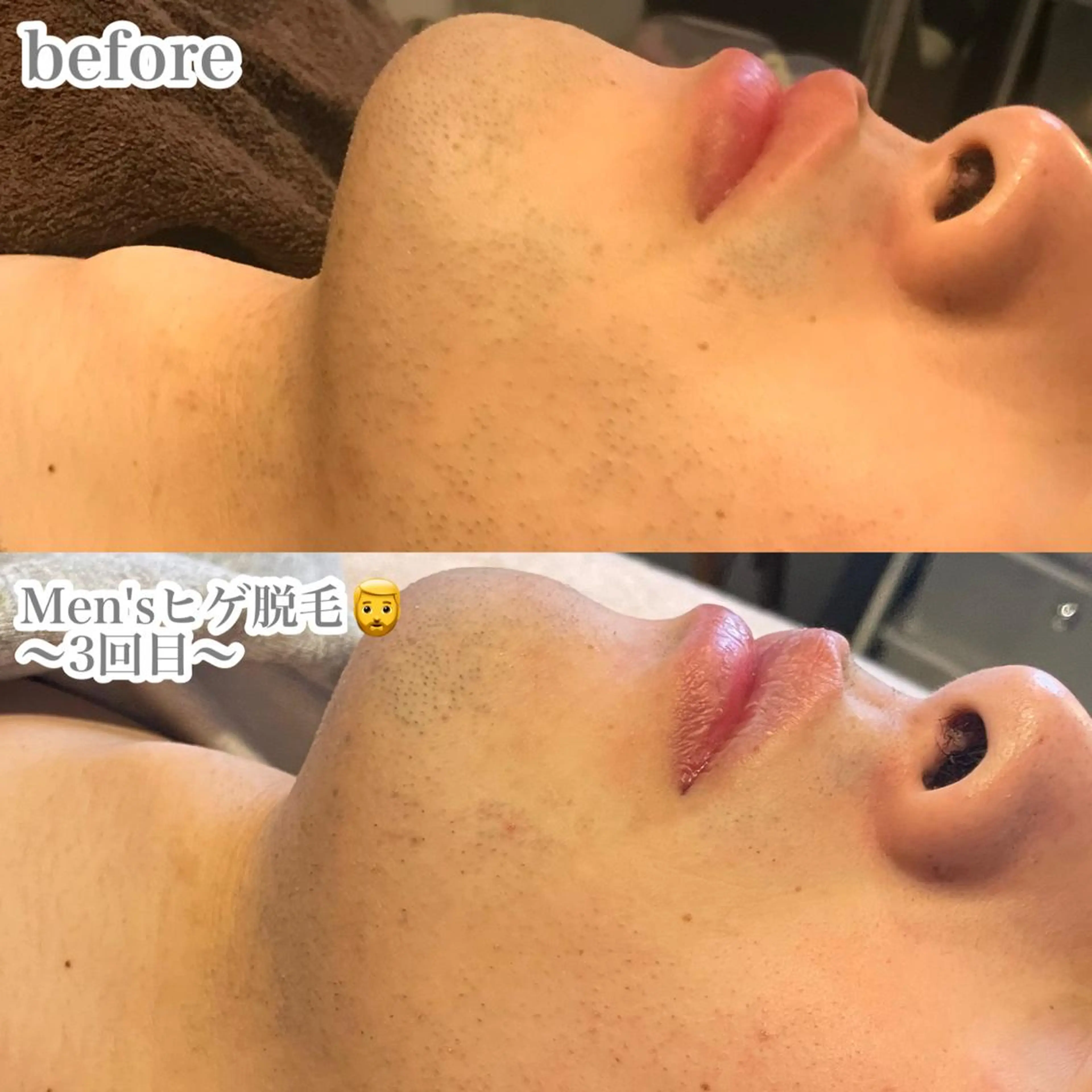 脱毛 浜野 恵美のエステ・リラクイメージ