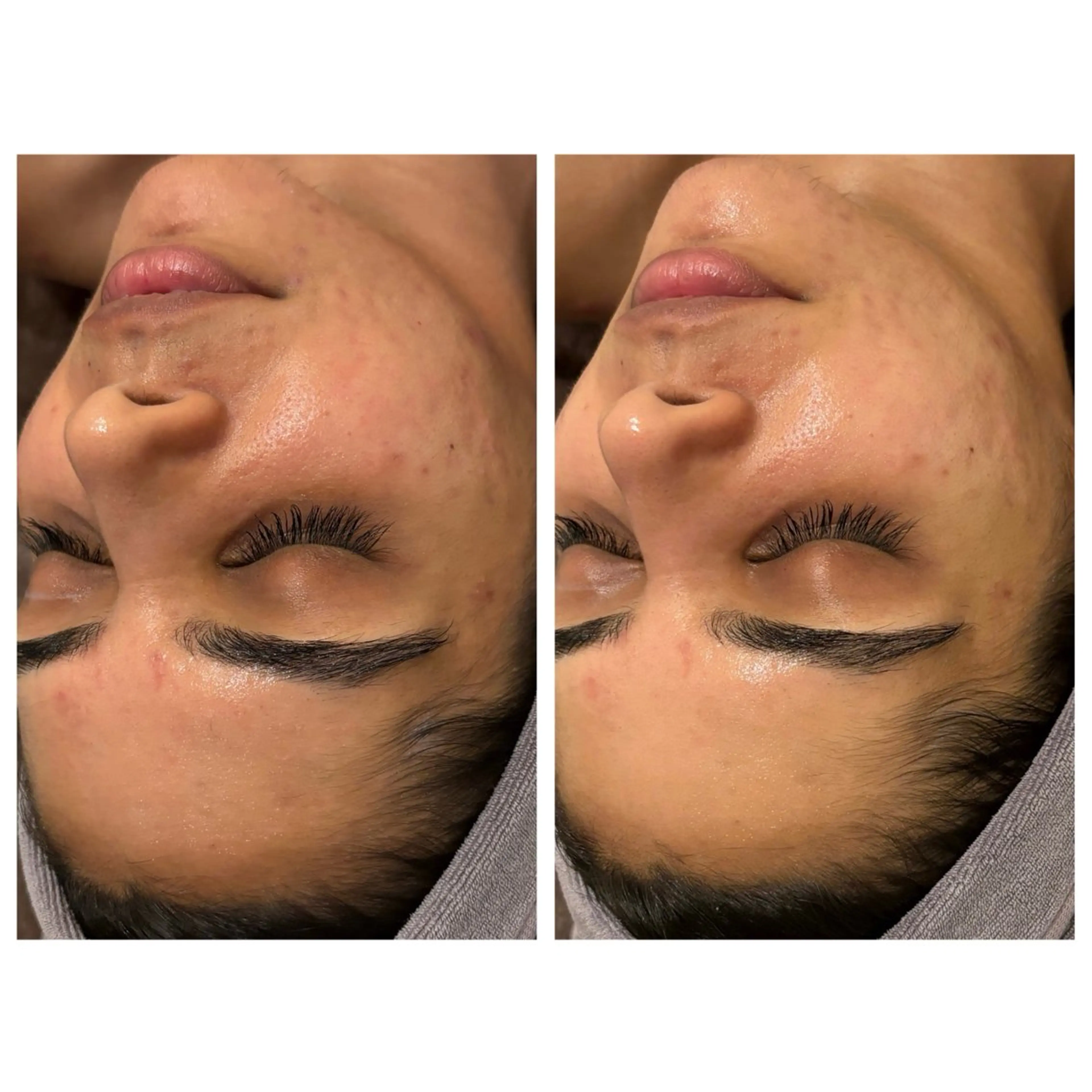 小顔コルギ ☆表参道/外苑前のエステ・リラクイメージ