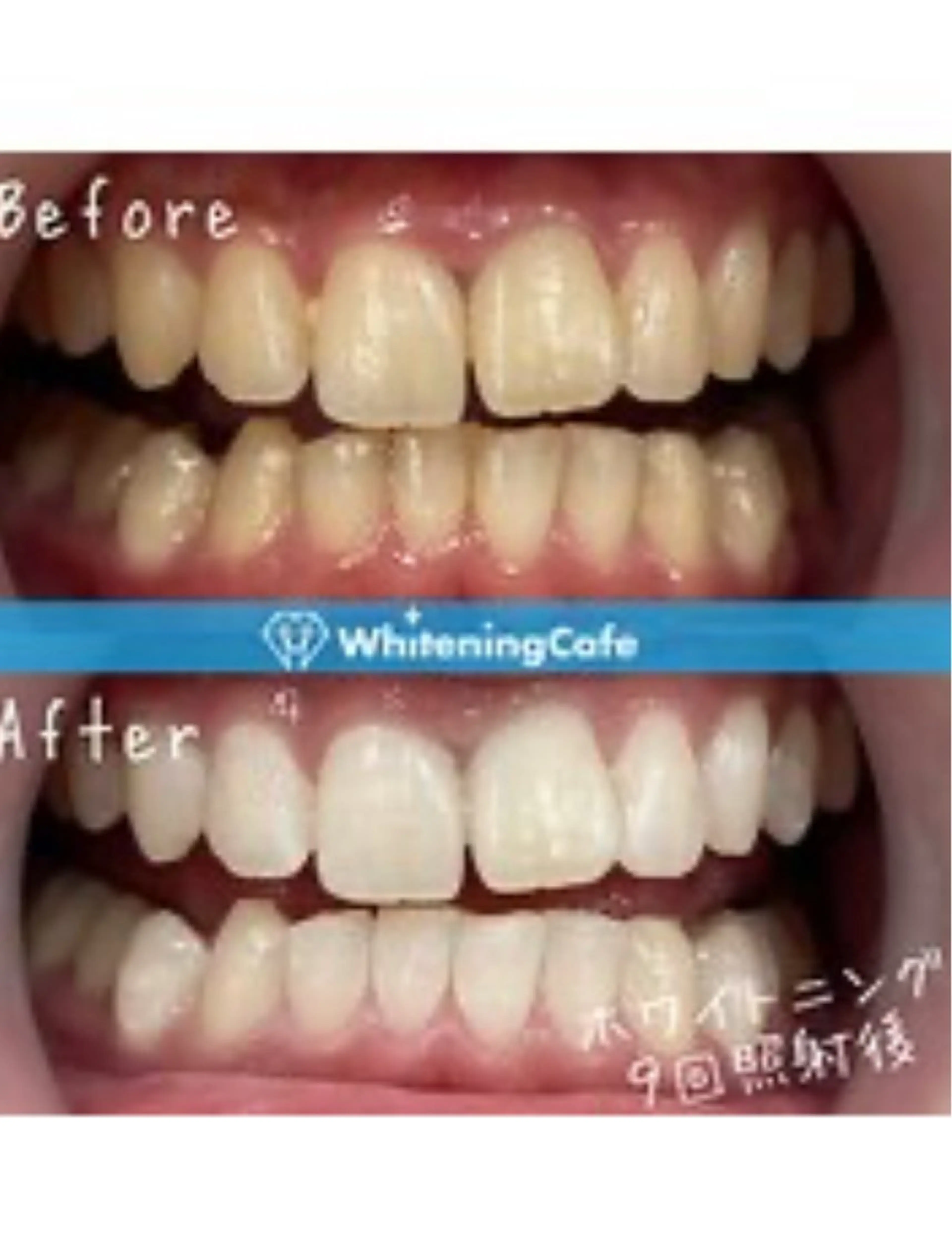 ホワイトニングカフェ荻窪店所属・ホワイトニングカフェ 荻窪店のその他イメージ