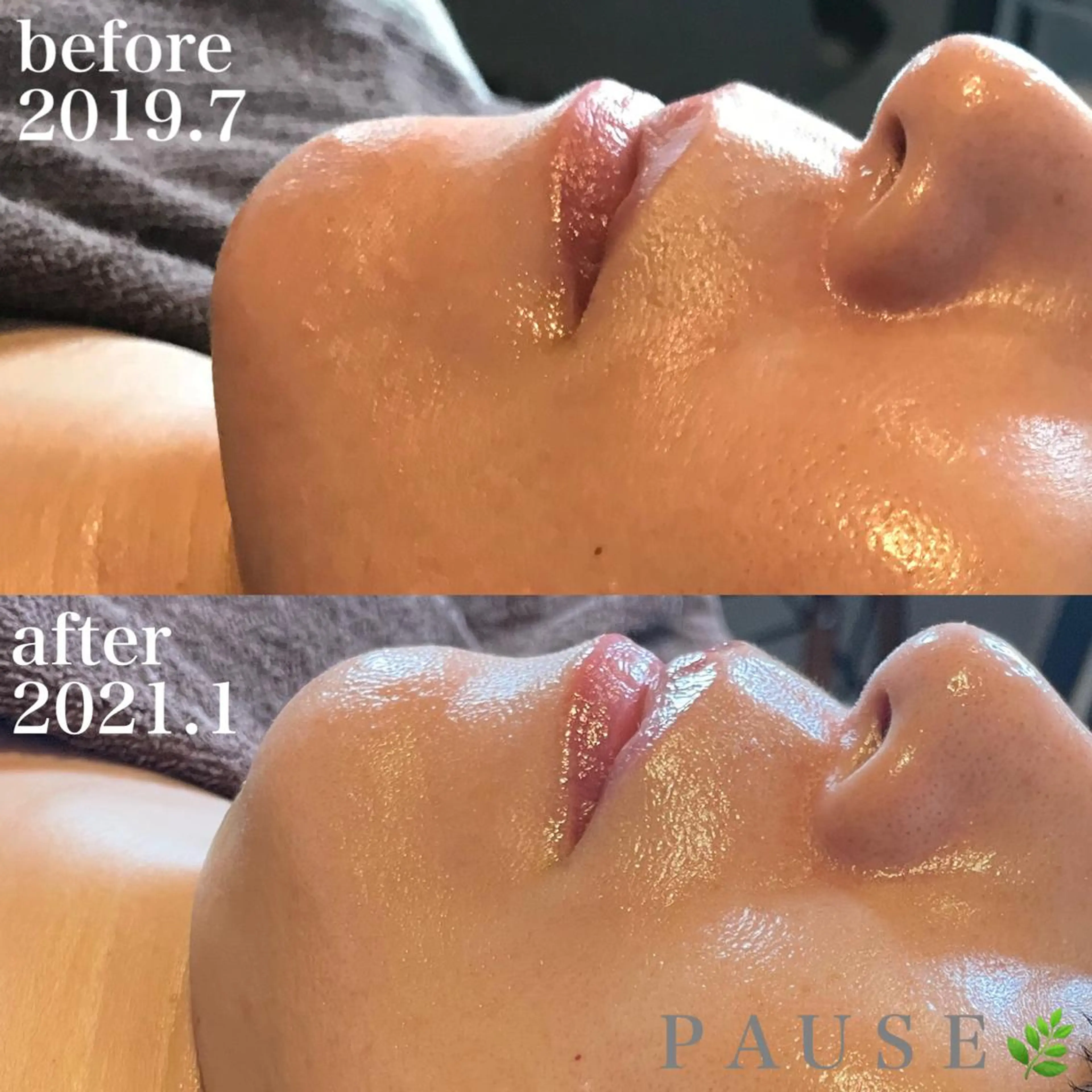 エステ 浜野 恵美のエステ・リラクイメージ