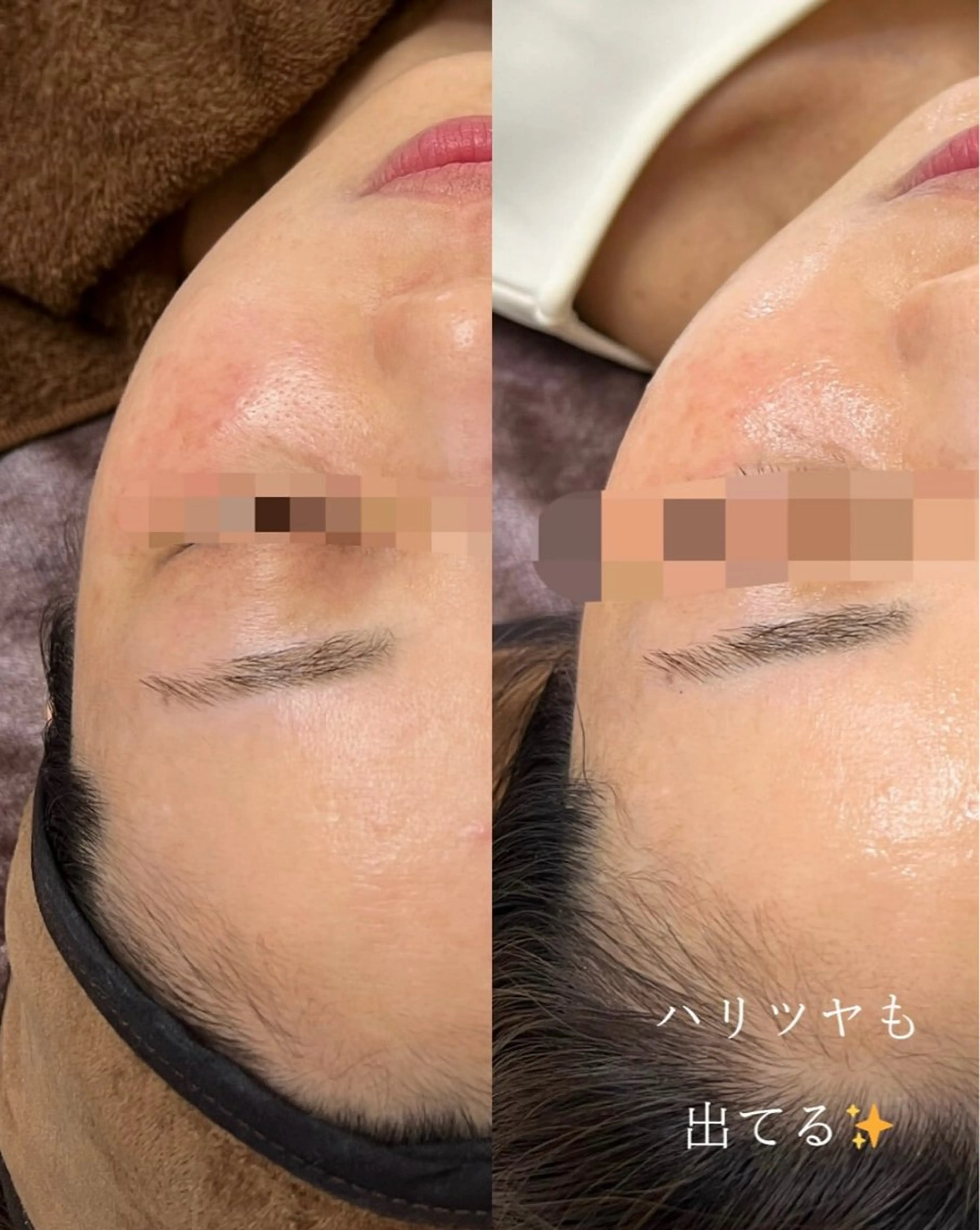 Nsが施術するサロン ナスサロ /Yuriのエステ・リラクイメージ