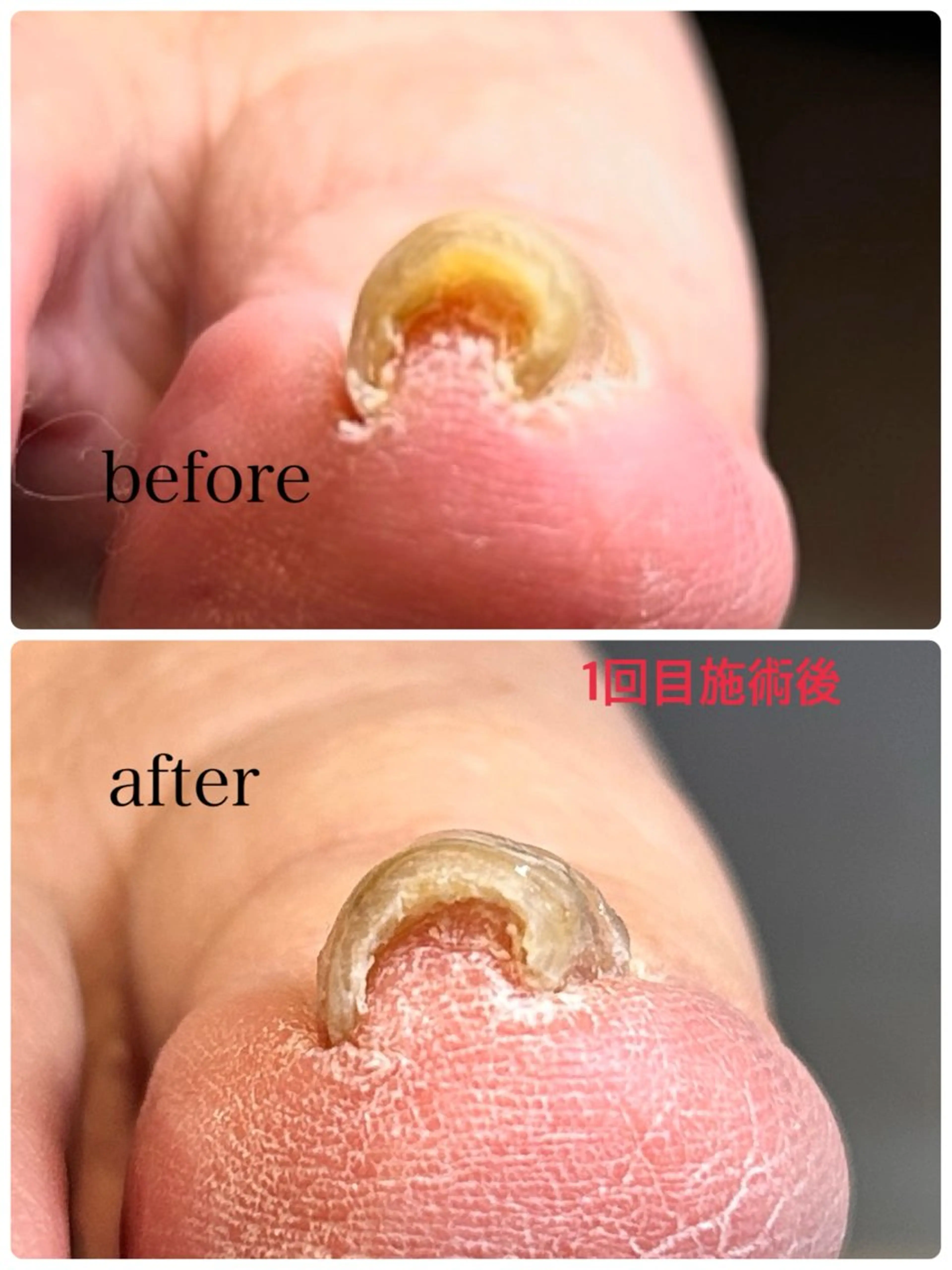 その他(ネイル) N.style所属・Ｎ. styleのネイルデザイン