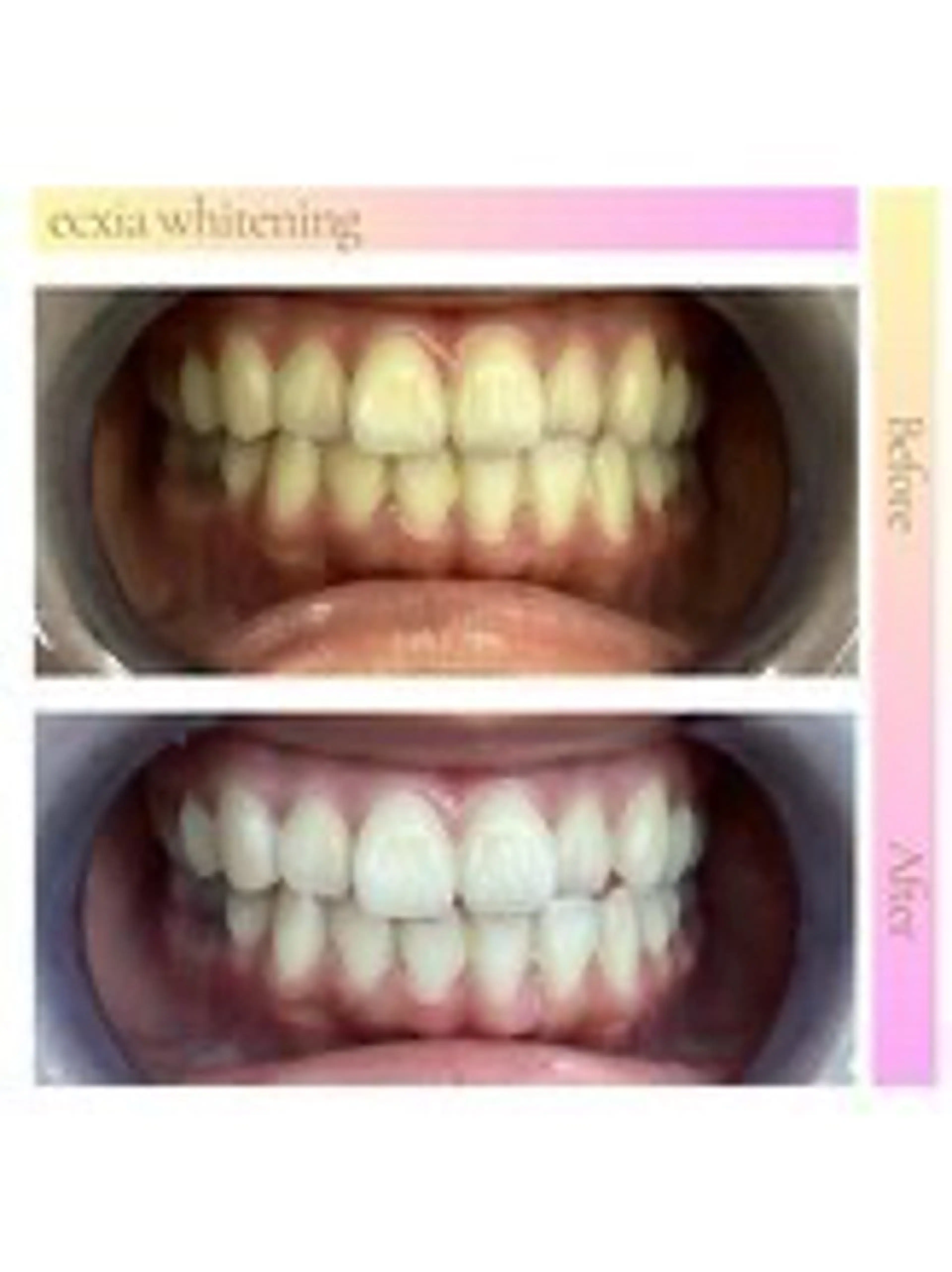 セルフホワイトニング エクシア西宮北口店所属・セルフホワイトニング エクシア西宮北口店のその他イメージ