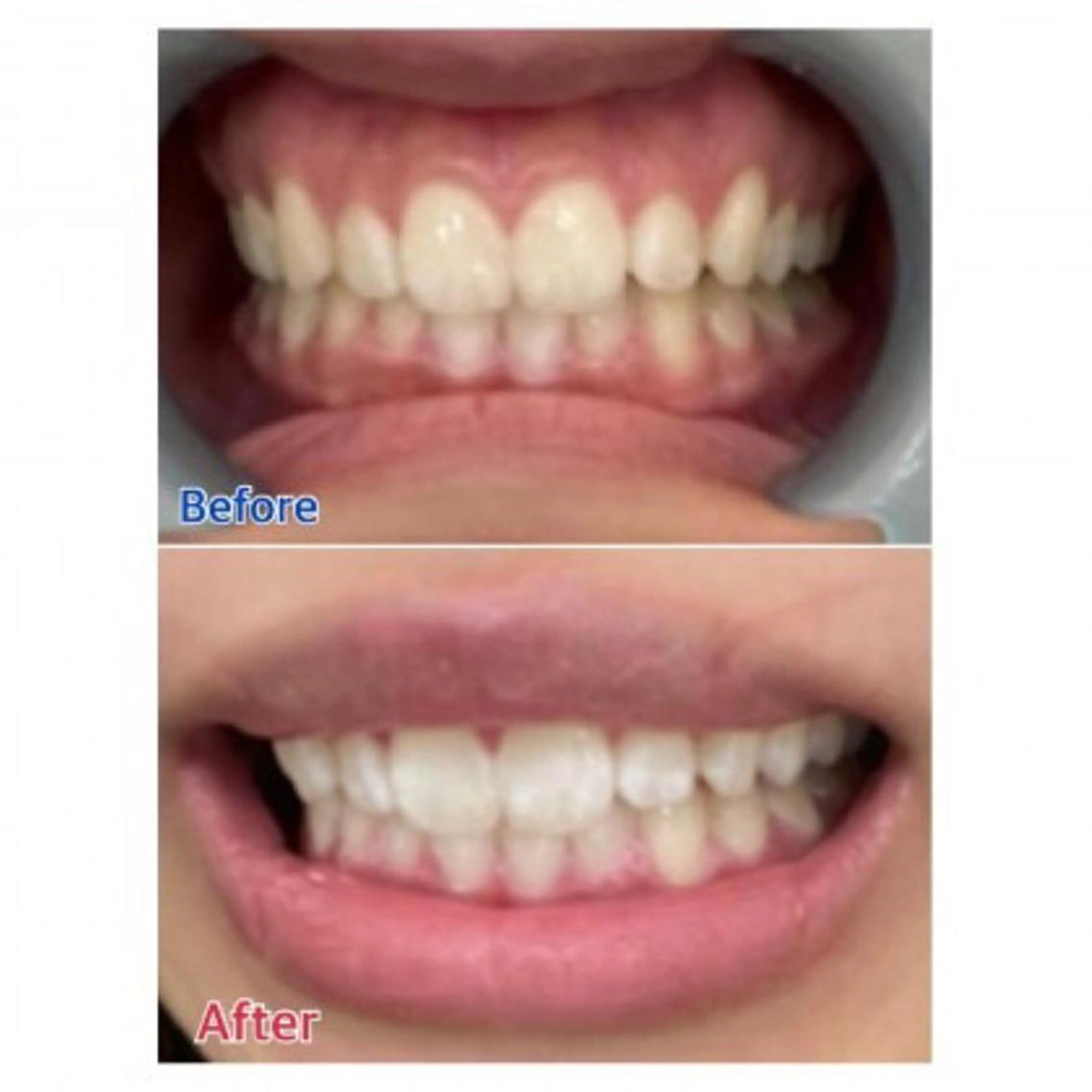 M渋谷店所属・Ｍ渋谷 ホワイトニングのエステ・リラクイメージ