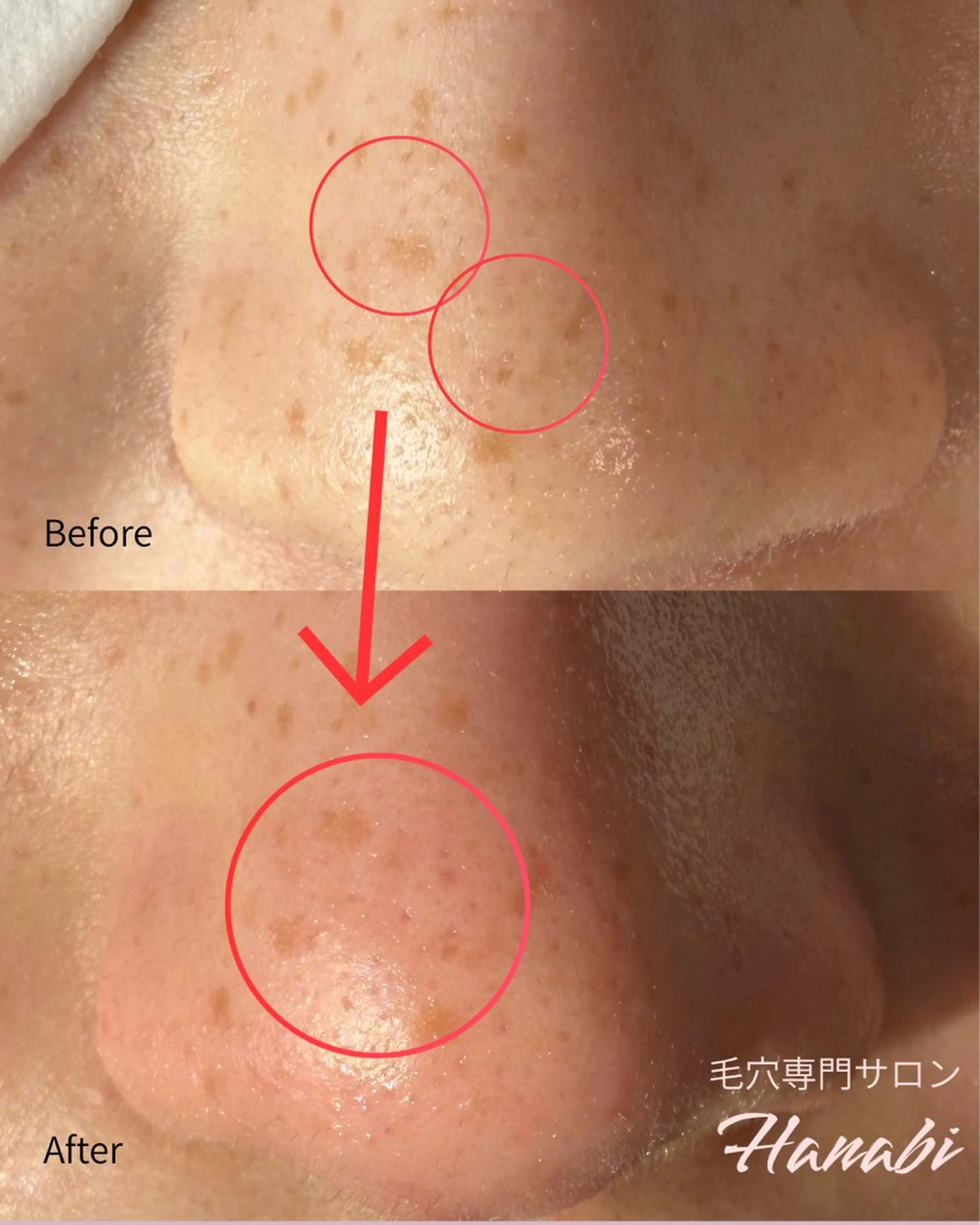 エステ 毛穴専門サロン Hanabiのエステ・リラクイメージ