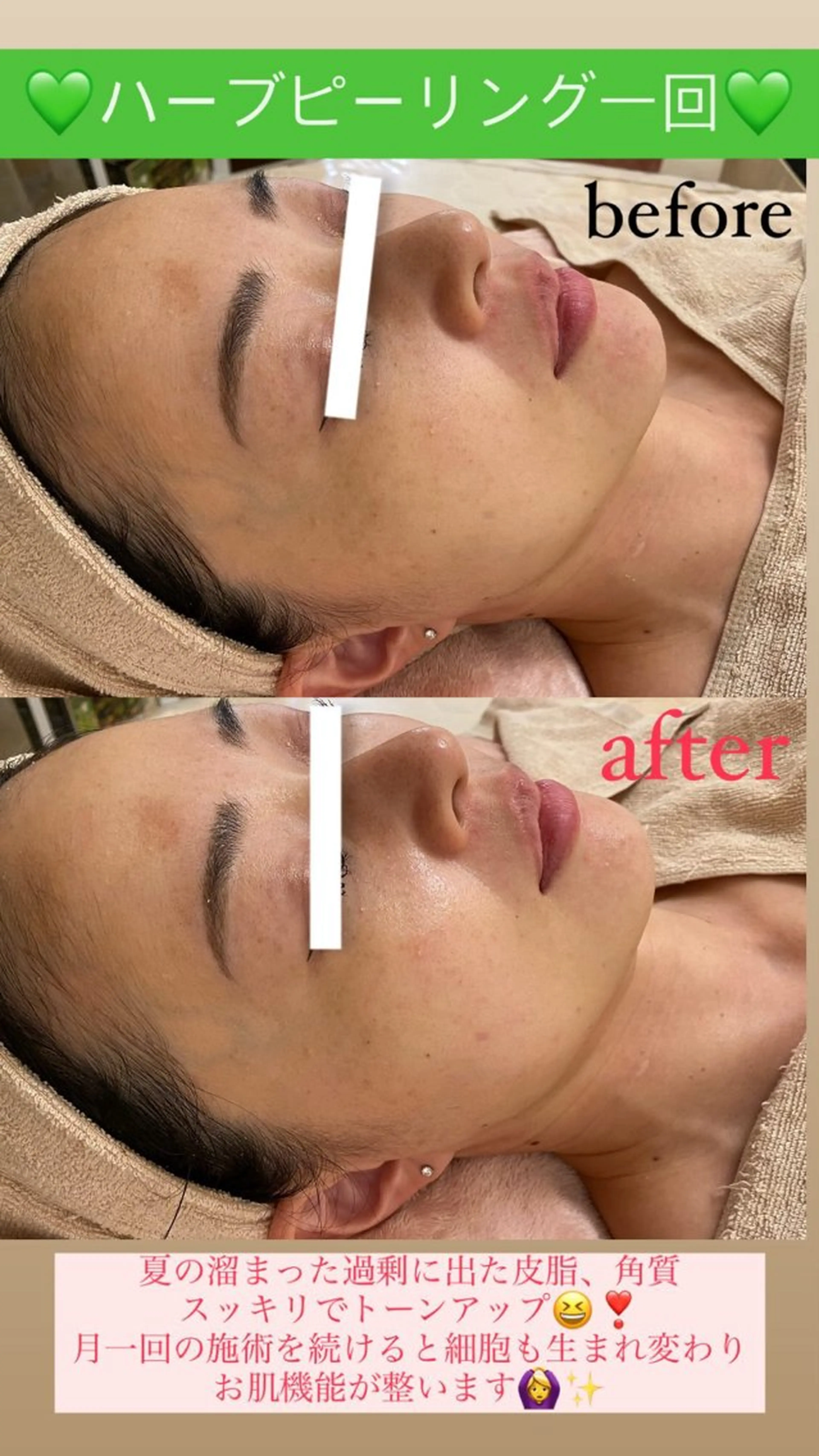 メンズ エステ Salon de Lino 御器所のエステ・リラクイメージ