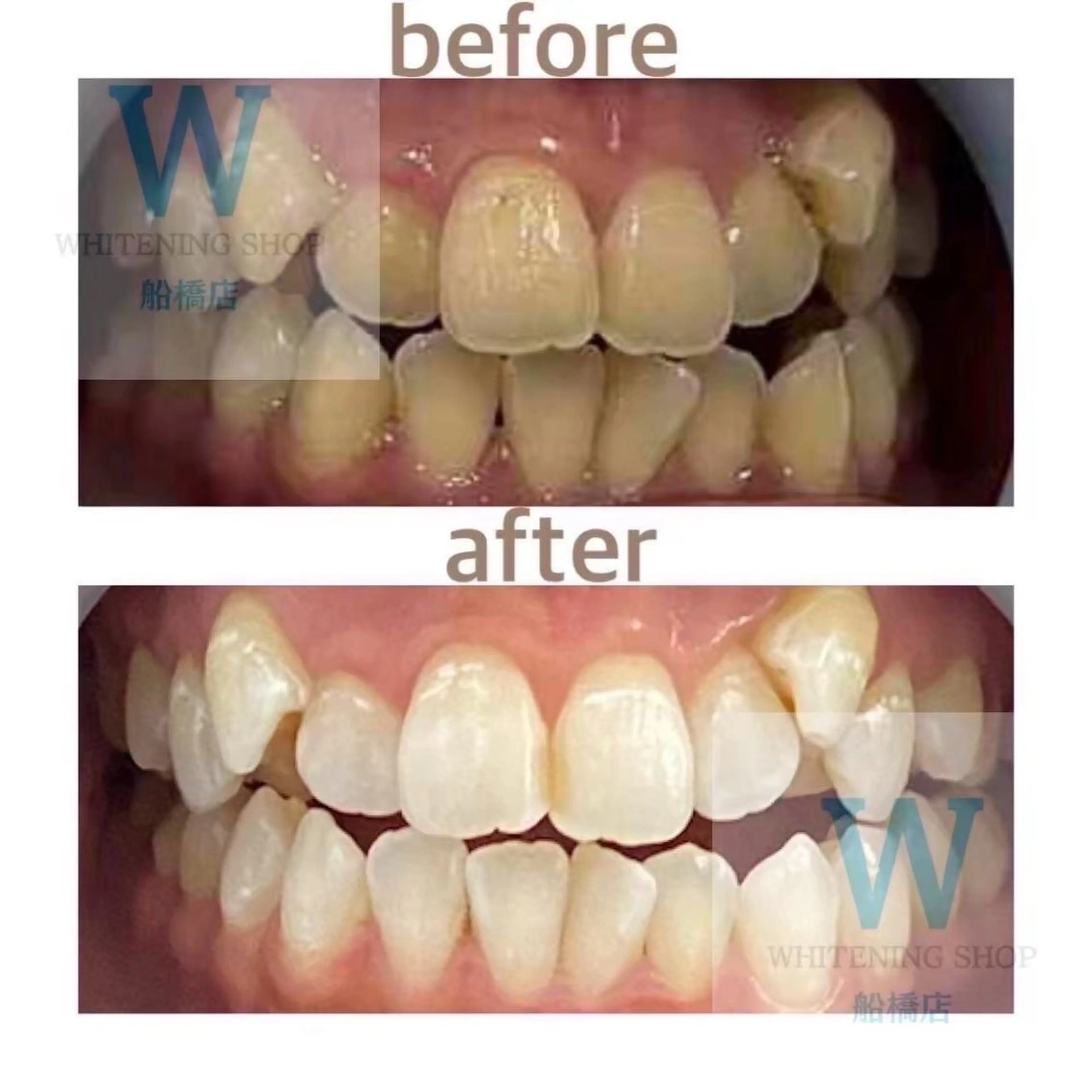 エステ リラク ホワイトニング ショップ船橋店🦷のエステ・リラクイメージ