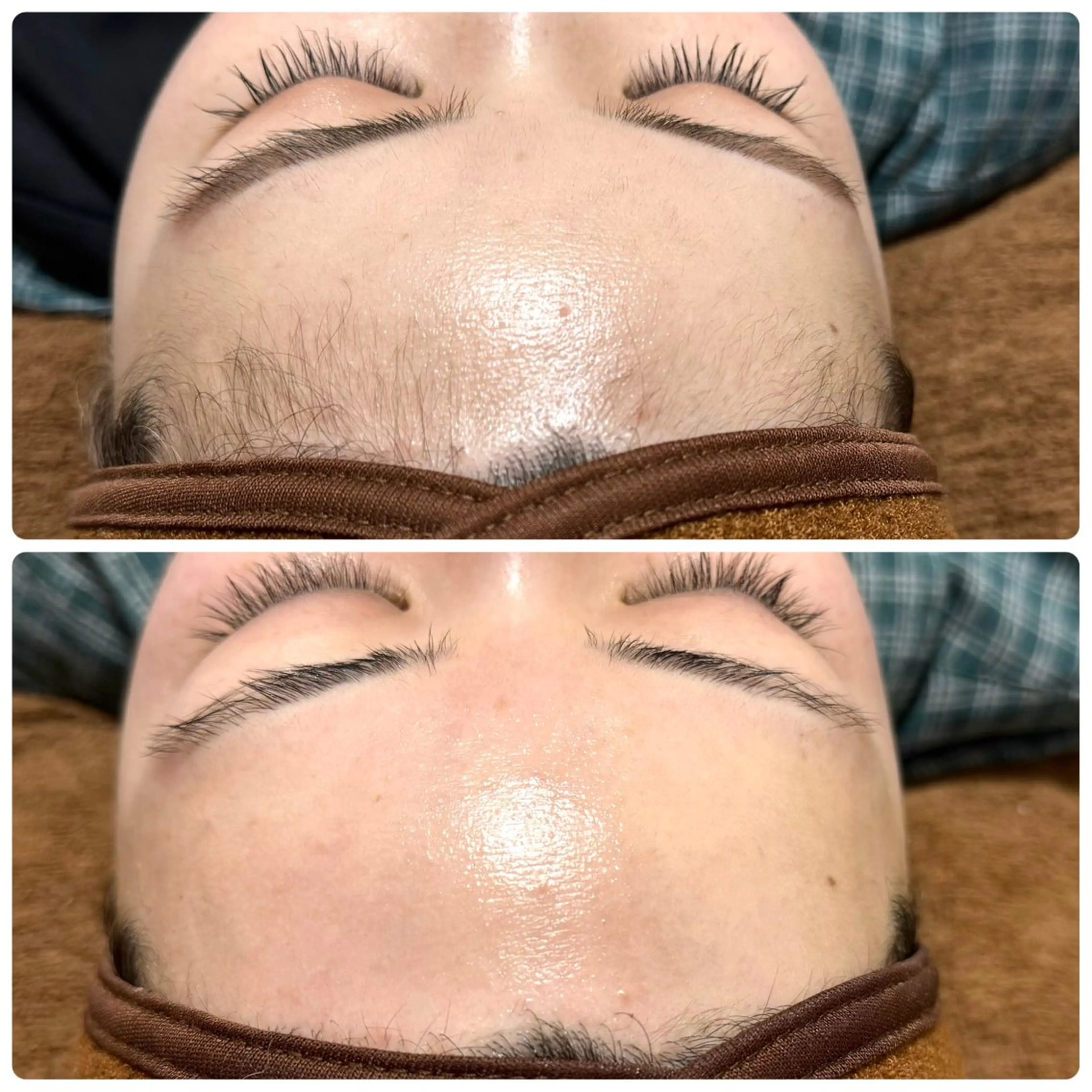 《ミニモ限定価格❤️‍🔥》フェイシャルワックス脱毛🌿～クレンジング,洗顔,保湿,Wax,高保湿パック～の写真