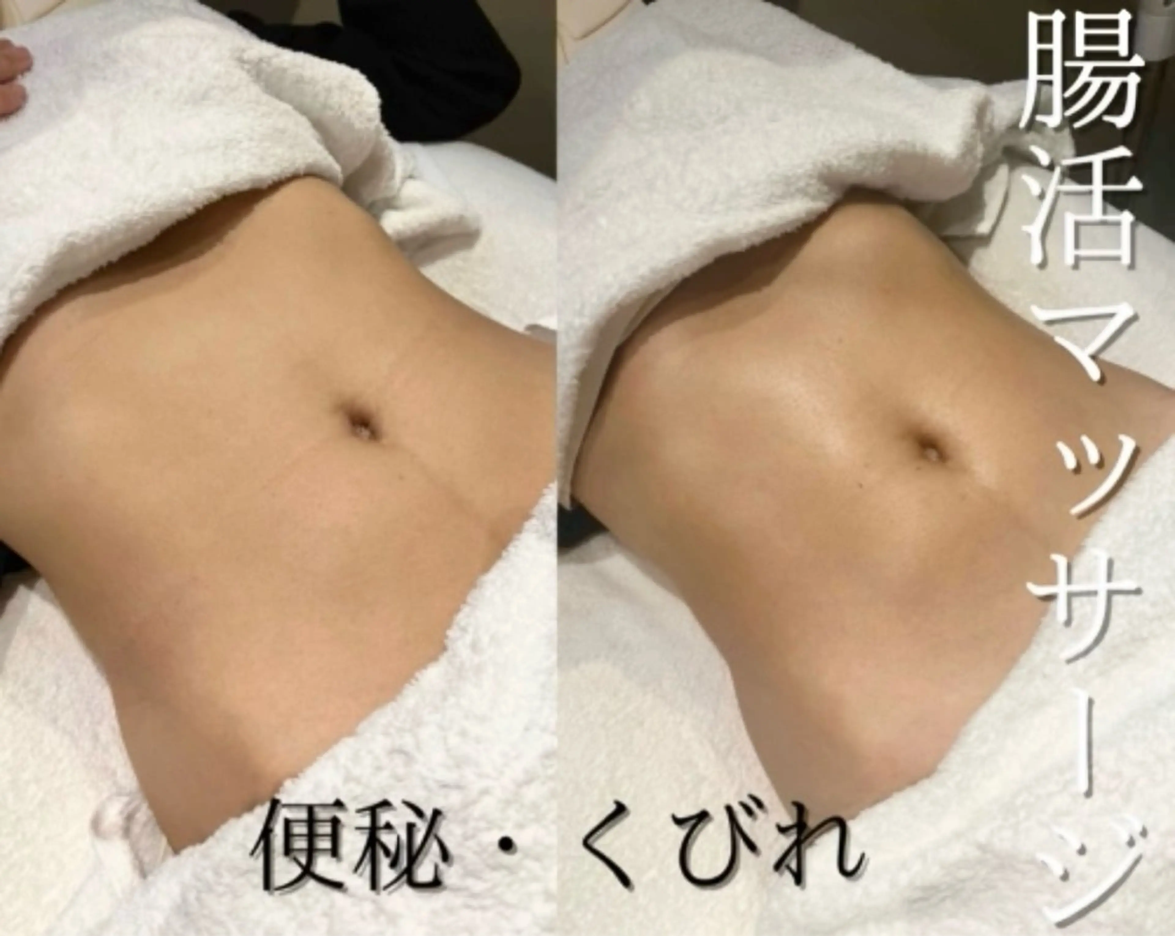 1日3名様限定🖤便秘解消🖤ぽっこりお腹＆くびれメイキング＆腸活マッサージ　30min憧れの縦線もget🫶🏼の写真