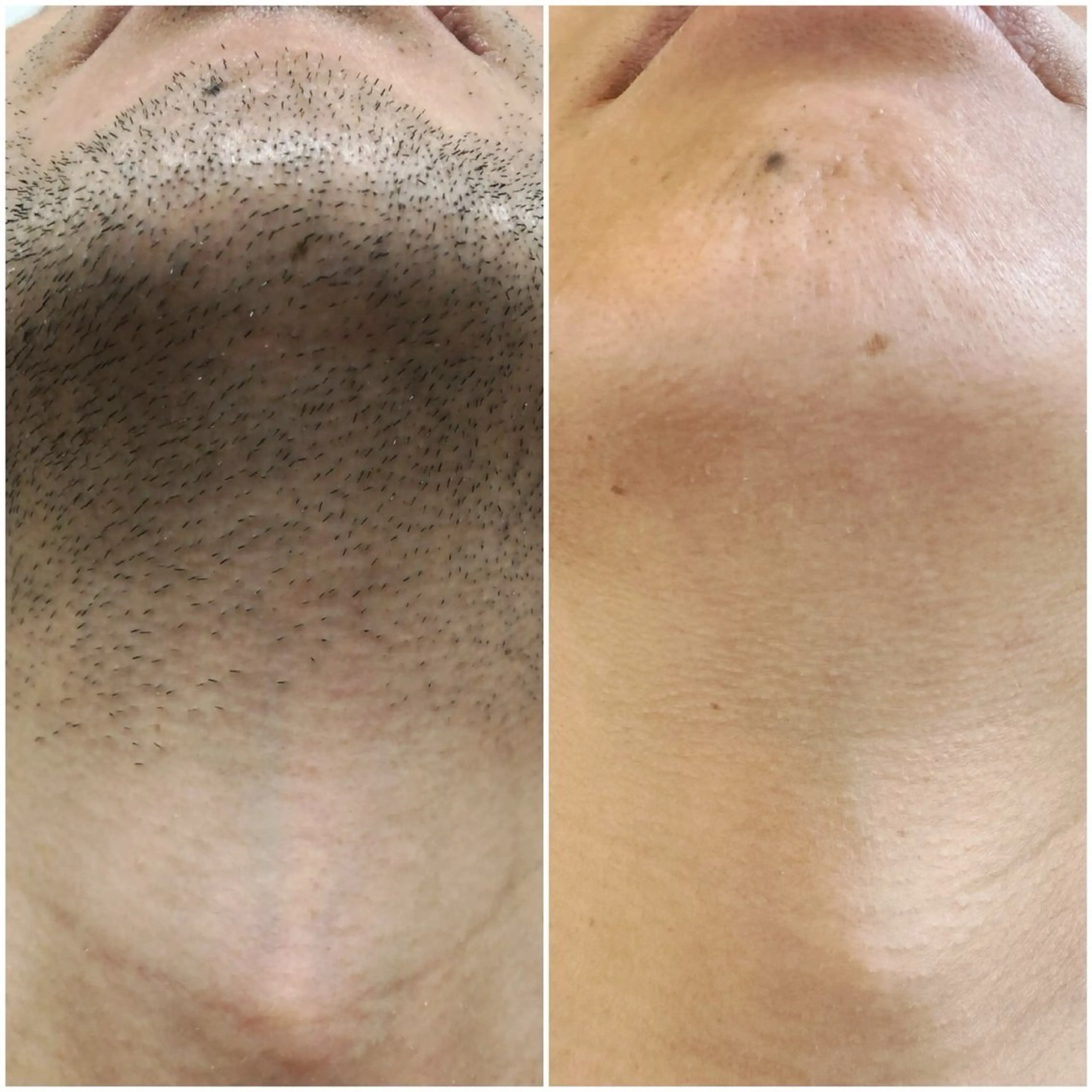 脱毛専門サロンElixir加須店所属・脱毛専門サロン Elixir　加須店のエステ・リラクイメージ