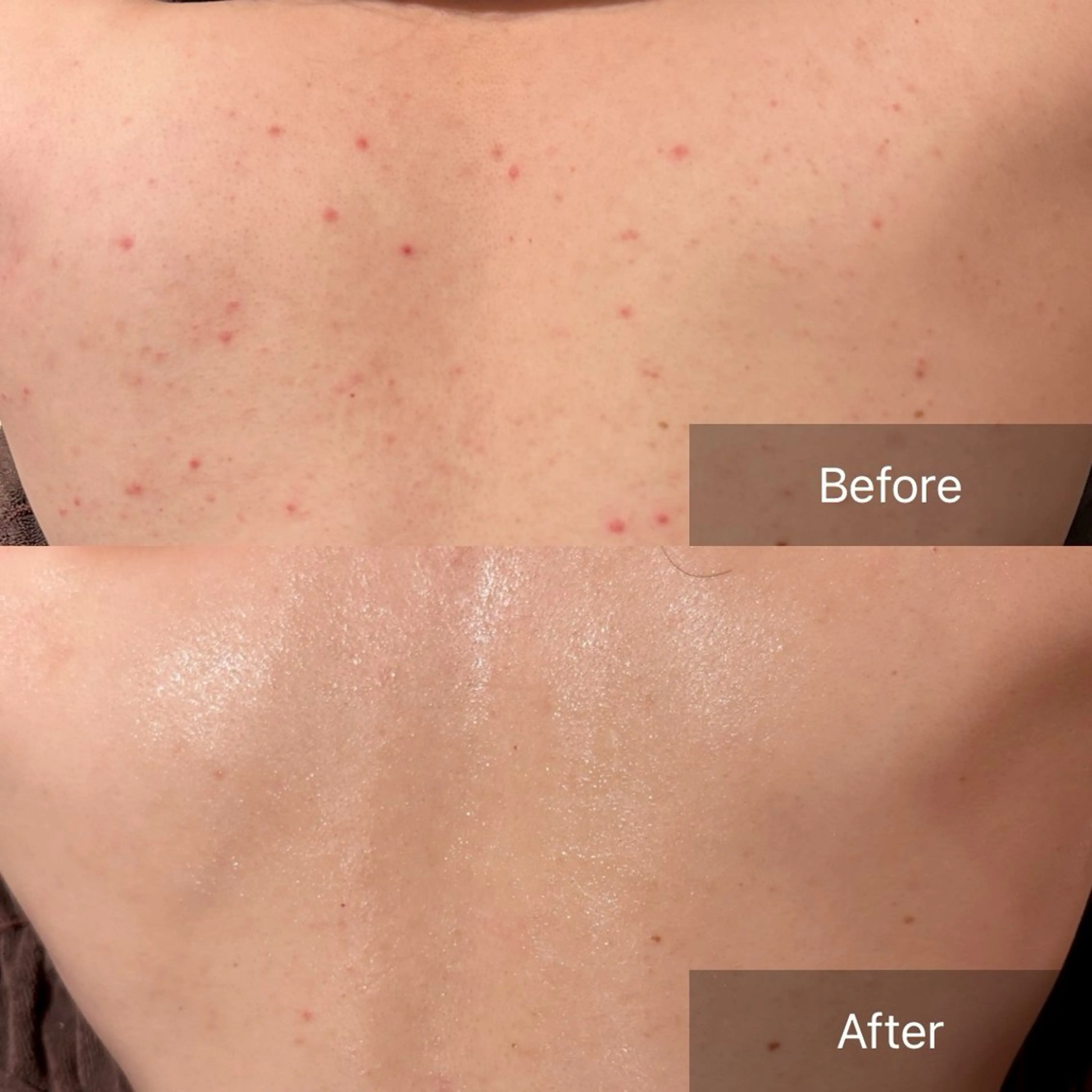 エステ for woman所属・森 美優のエステ・リラクイメージ