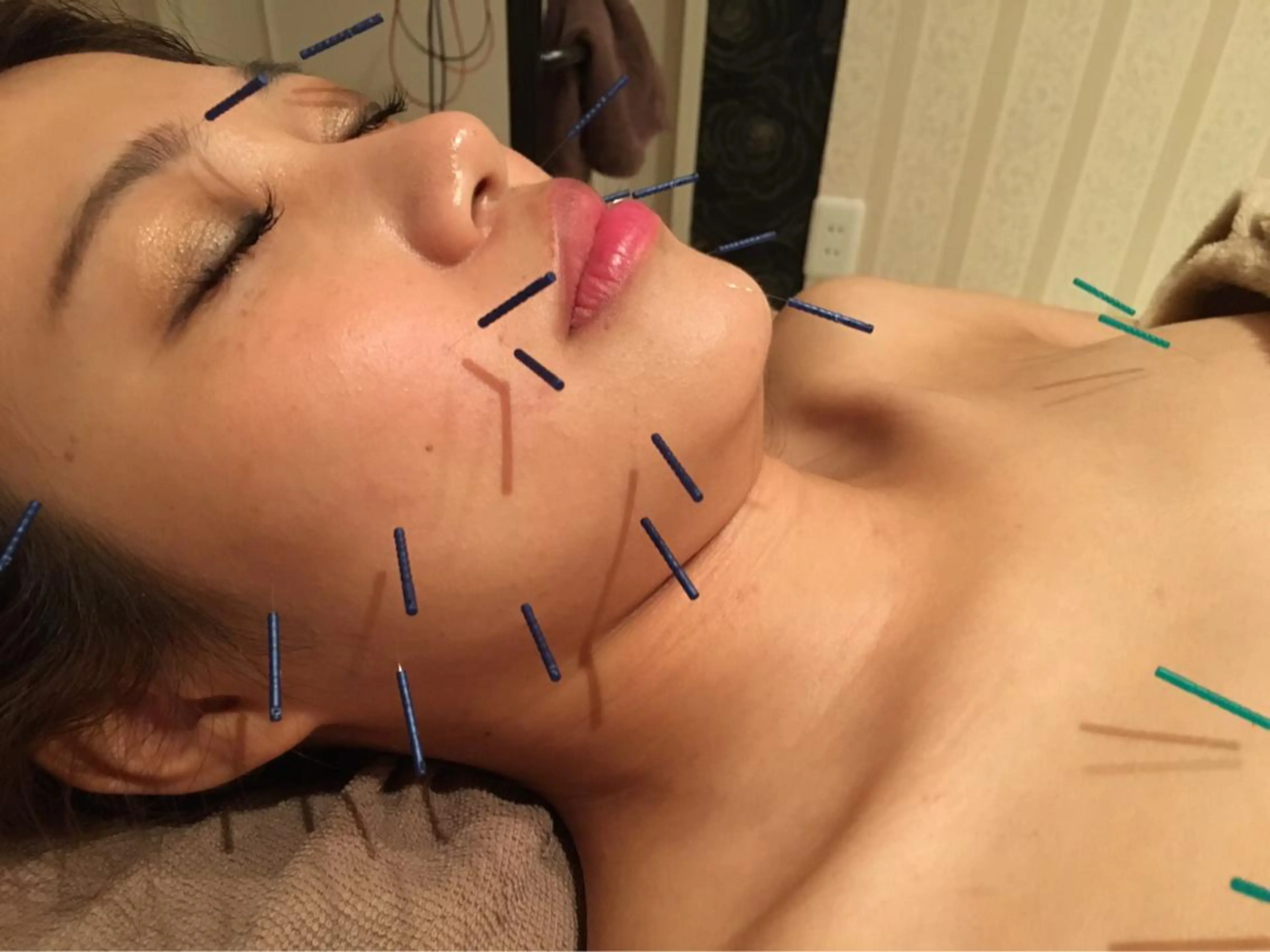 美容鍼サロン    Fleurir所属・伊藤 かなえのエステ・リラクイメージ