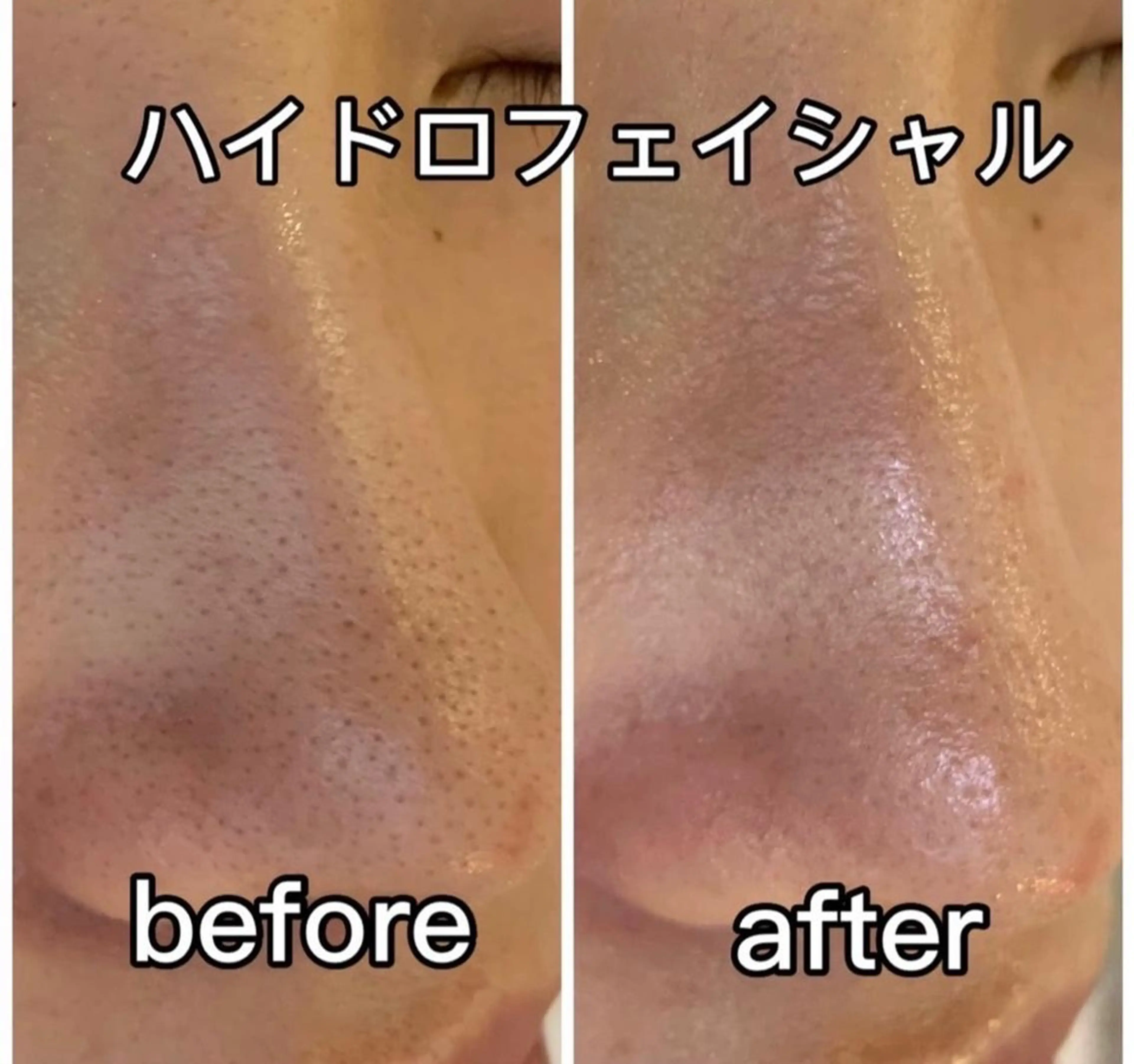 Une rencontre (ユヌ・ランコント)所属・つや肌専門店ユヌ・ ランコント中井のエステ・リラクイメージ