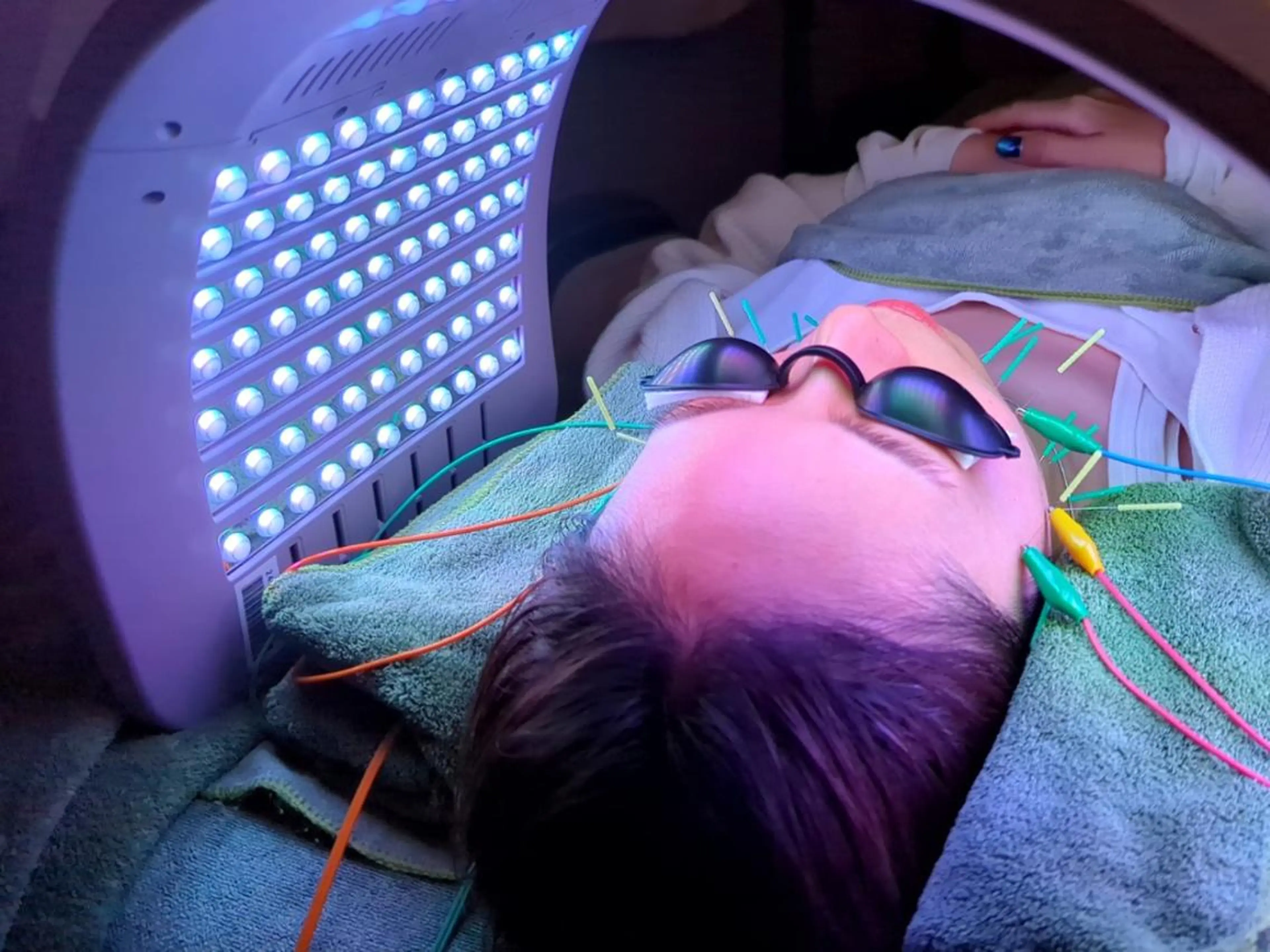 美容とカラダの鍼灸 サロン やなけんのエステ・リラクイメージ