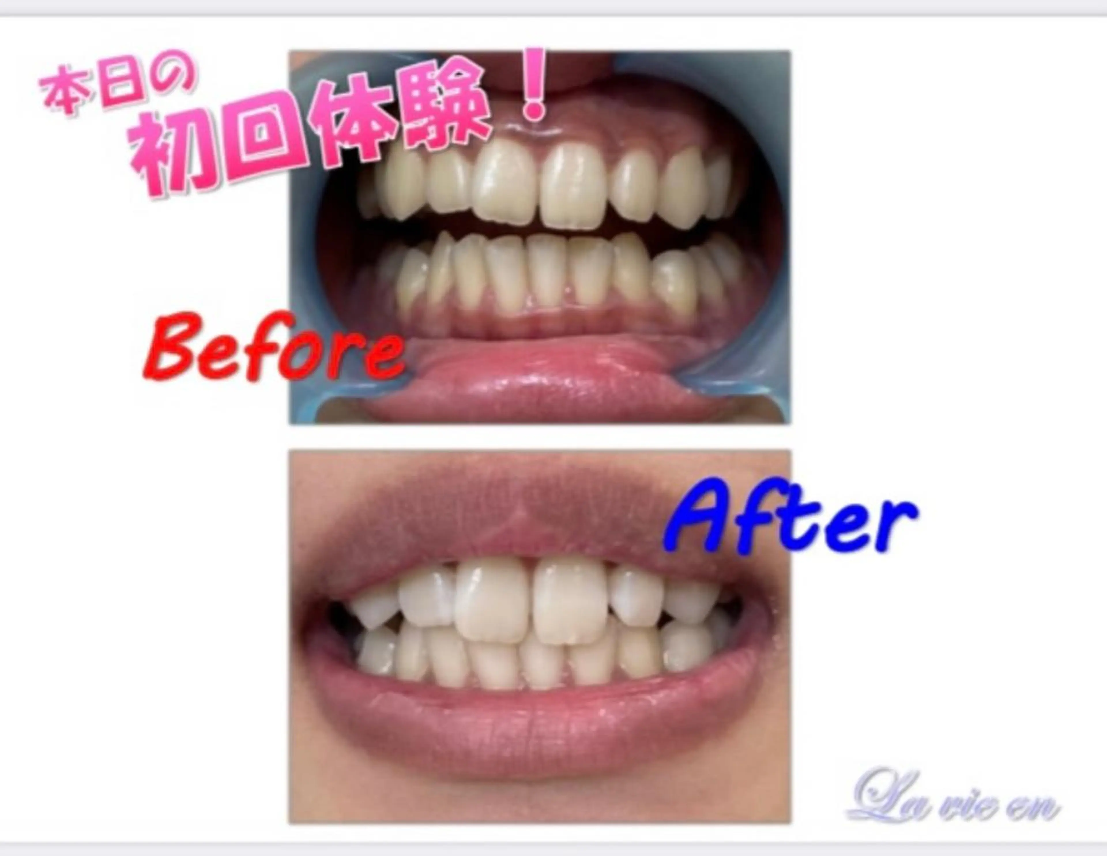 その他 セルフホワイトニングサロン　ラヴィアン所属・ホワイトニングサロン La vie enのその他イメージ