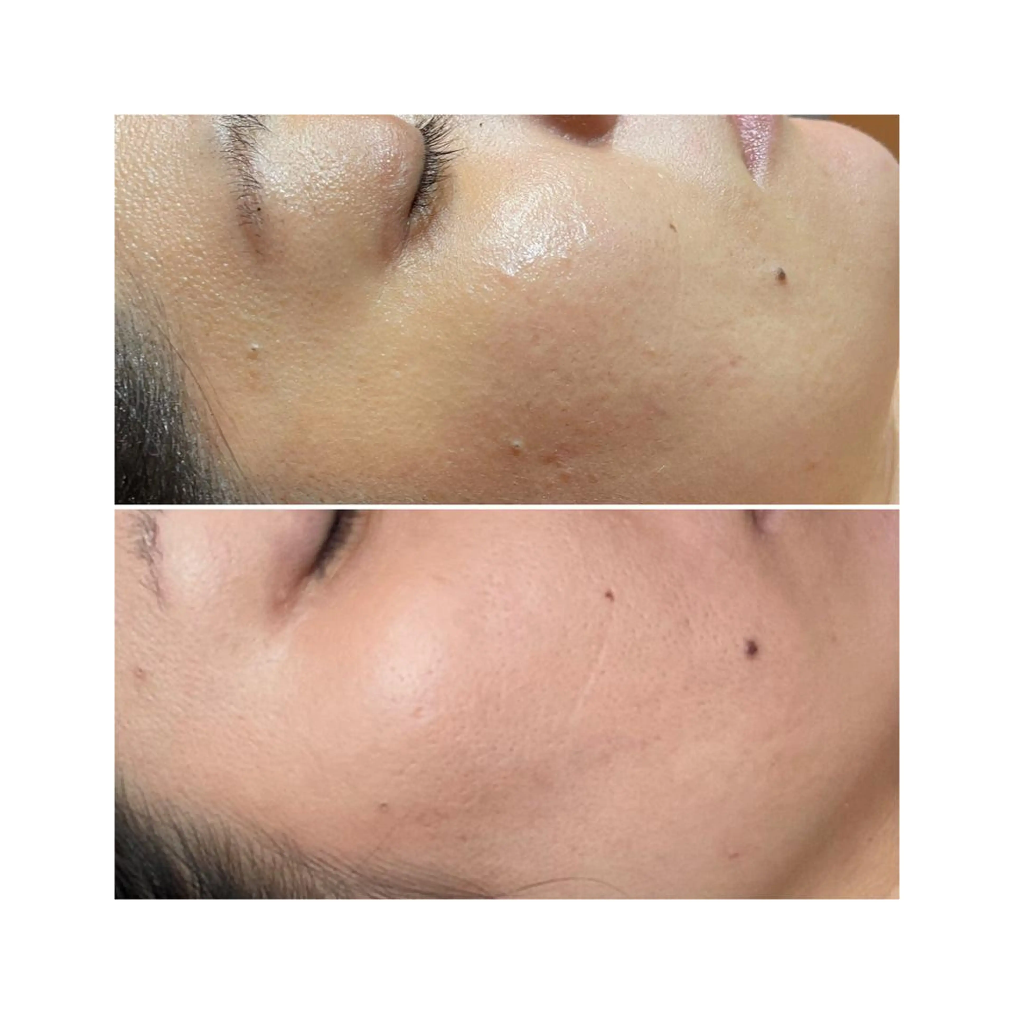 アロマ•ピーリング SalonYokoのその他イメージ