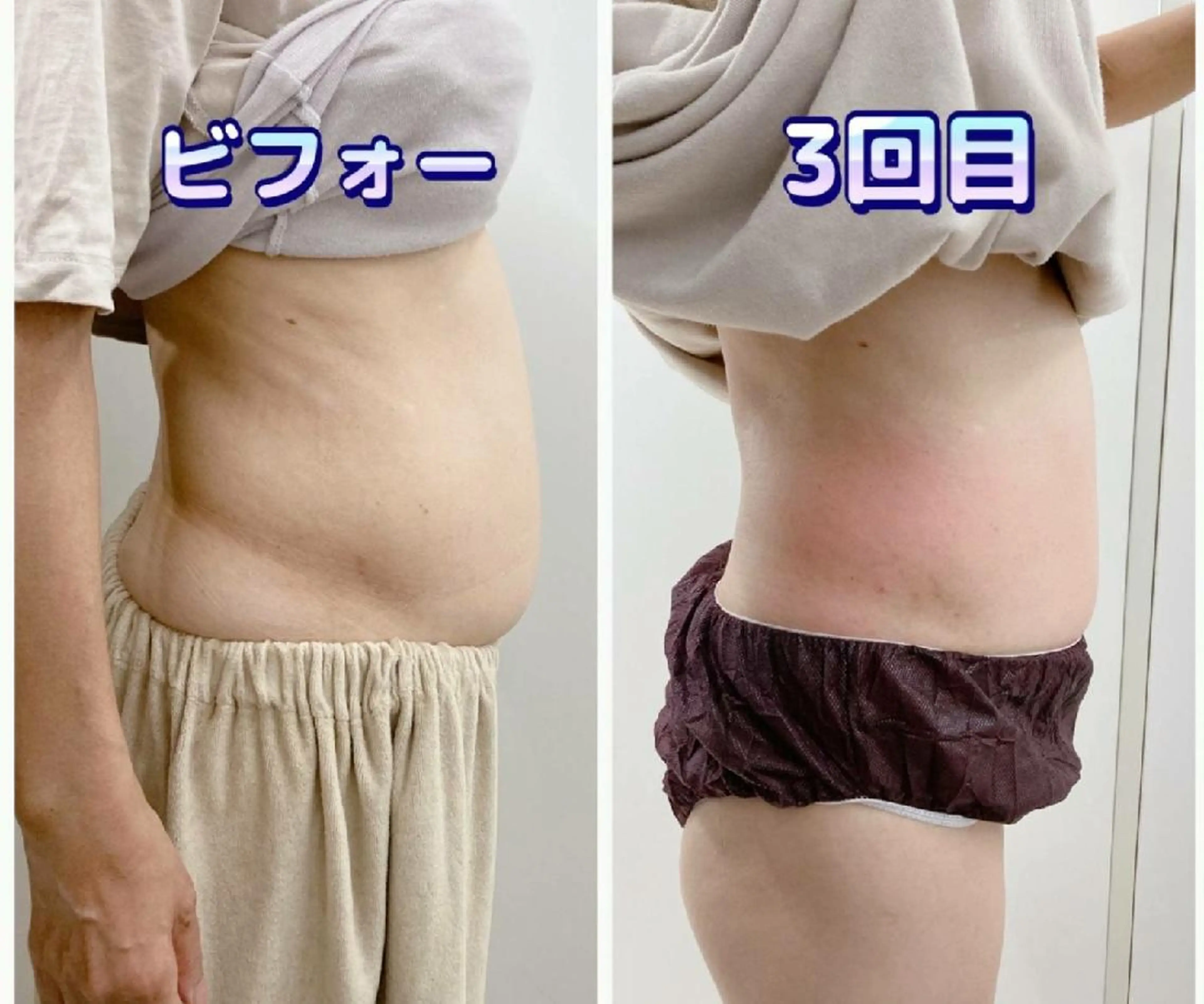 エステ ショールームエステbeco所属・ショールームエステ becoのエステ・リラクイメージ