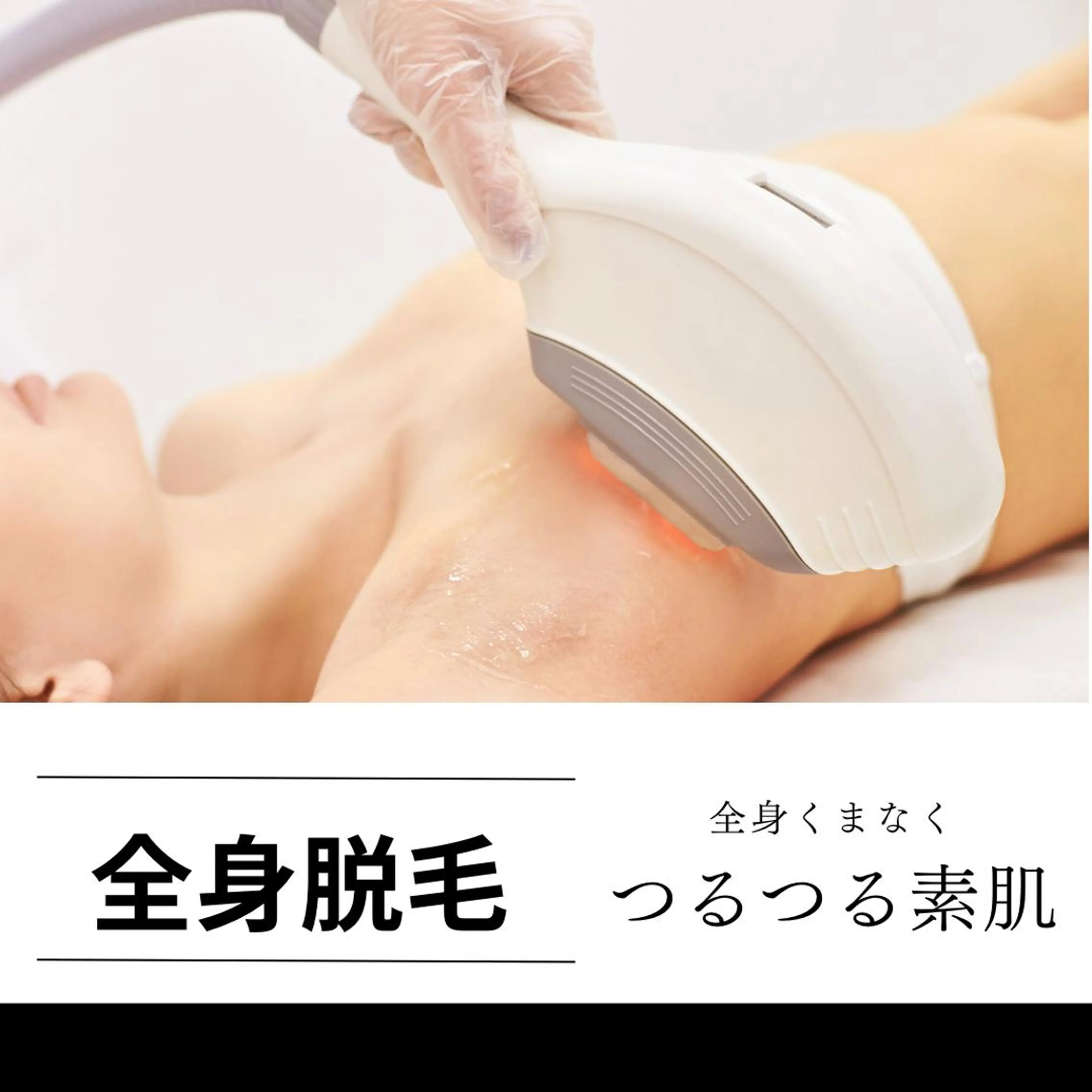 初めての脱毛人気No.3全身『お顔VIO無し』2回まで格安☆￥13400円→5500円の写真