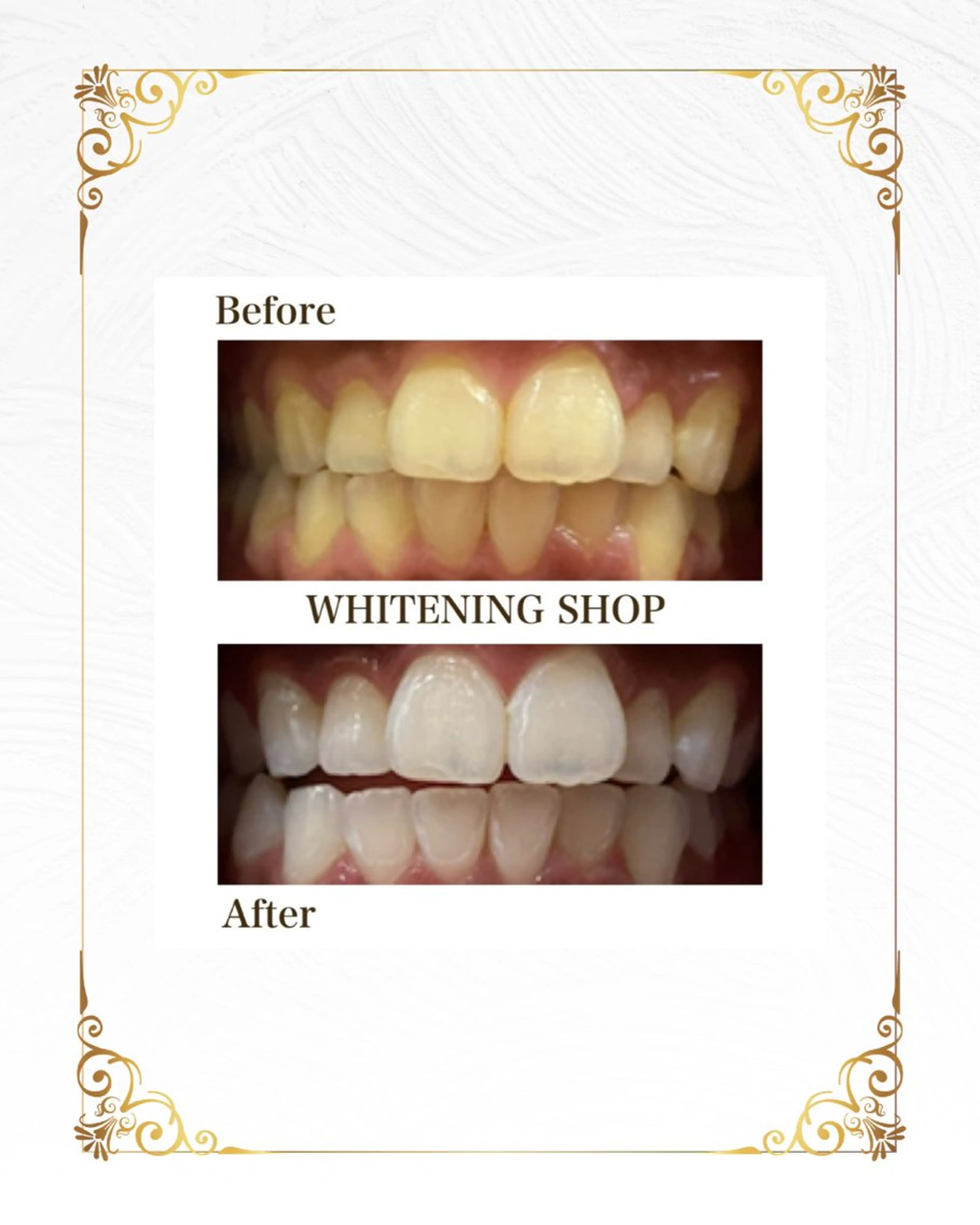 その他 ホワイトニングショップ静岡葵区店所属・ホワイトニング ショップ葵区静岡駅店のその他イメージ