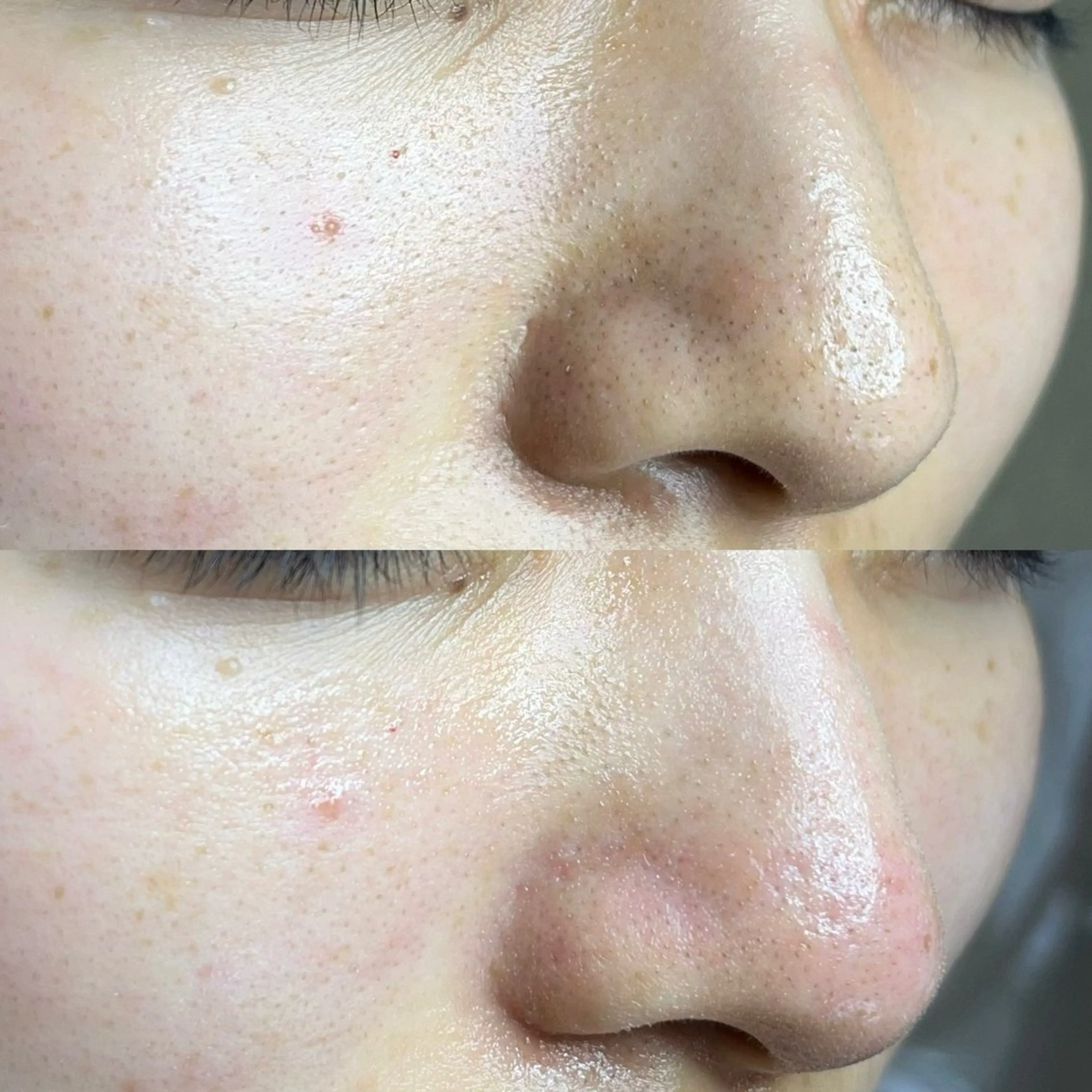 毛穴ケア・ヘッドスパサロンSHINY(シャイニー)所属・毛穴ケア・ヘッドスパ サロンSHINYのエステ・リラクイメージ