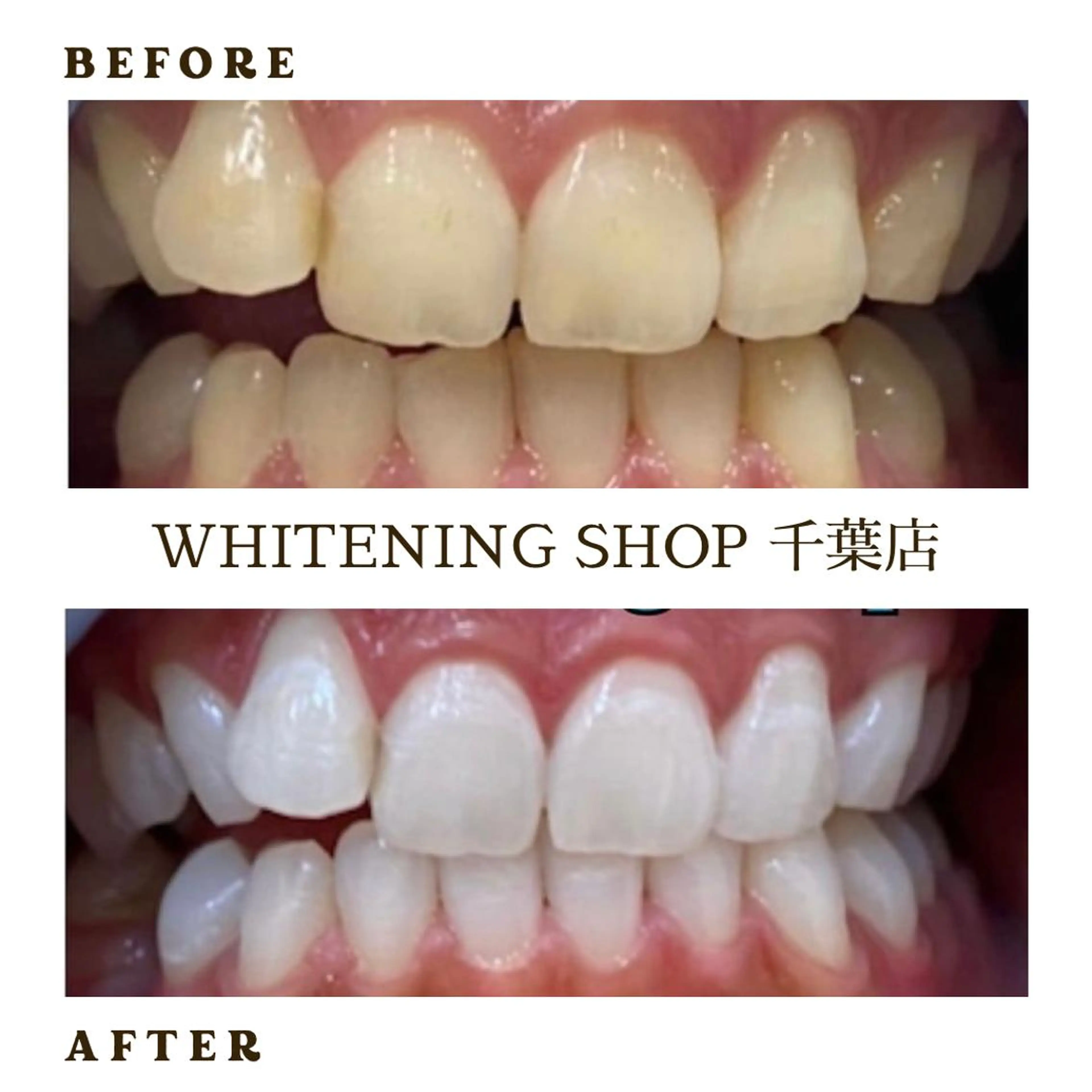 メンズ エステ ホワイトニング ショップ千葉店のその他イメージ