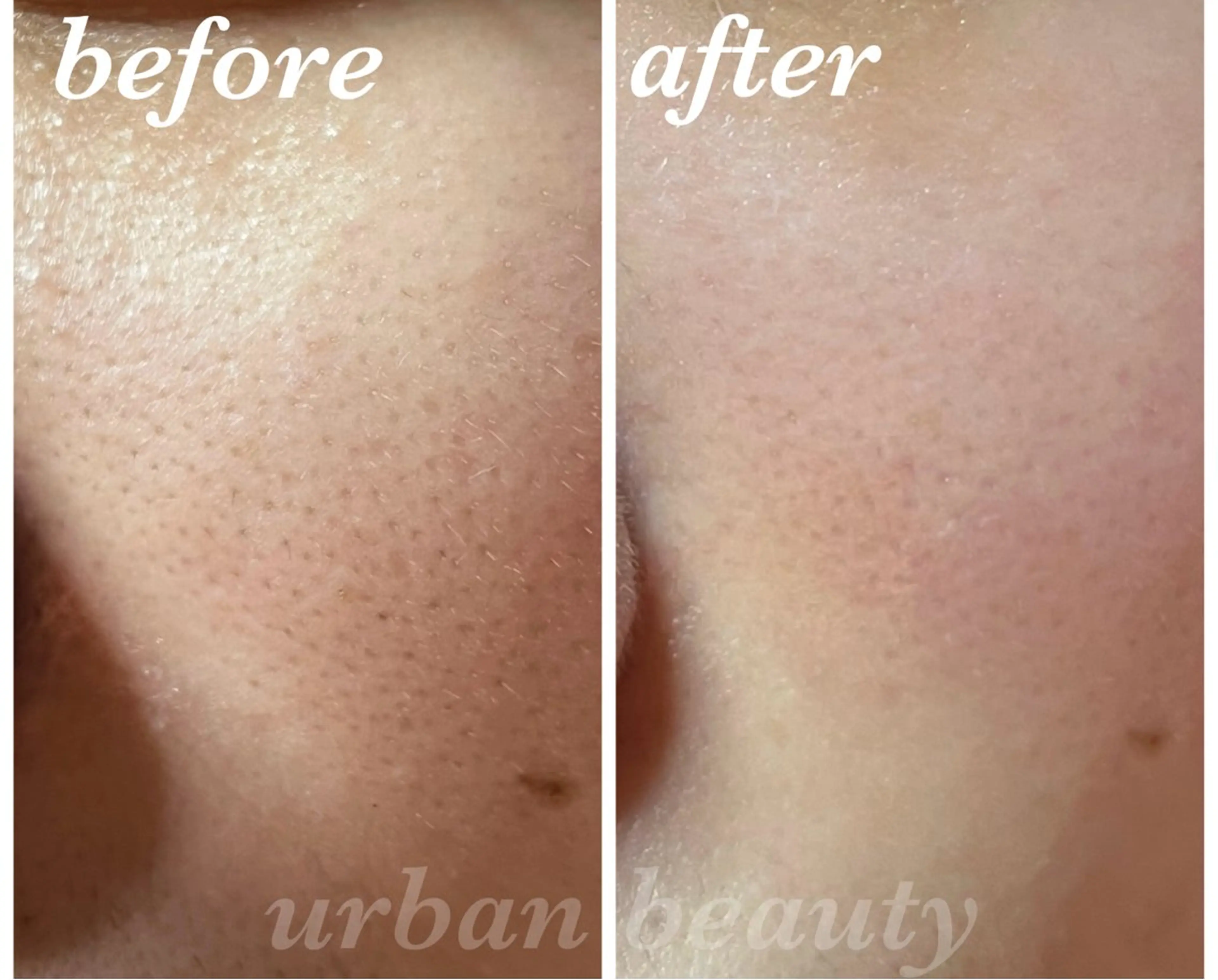 結果重視｜毛穴エステ ｜友綱理恵のエステ・リラクイメージ