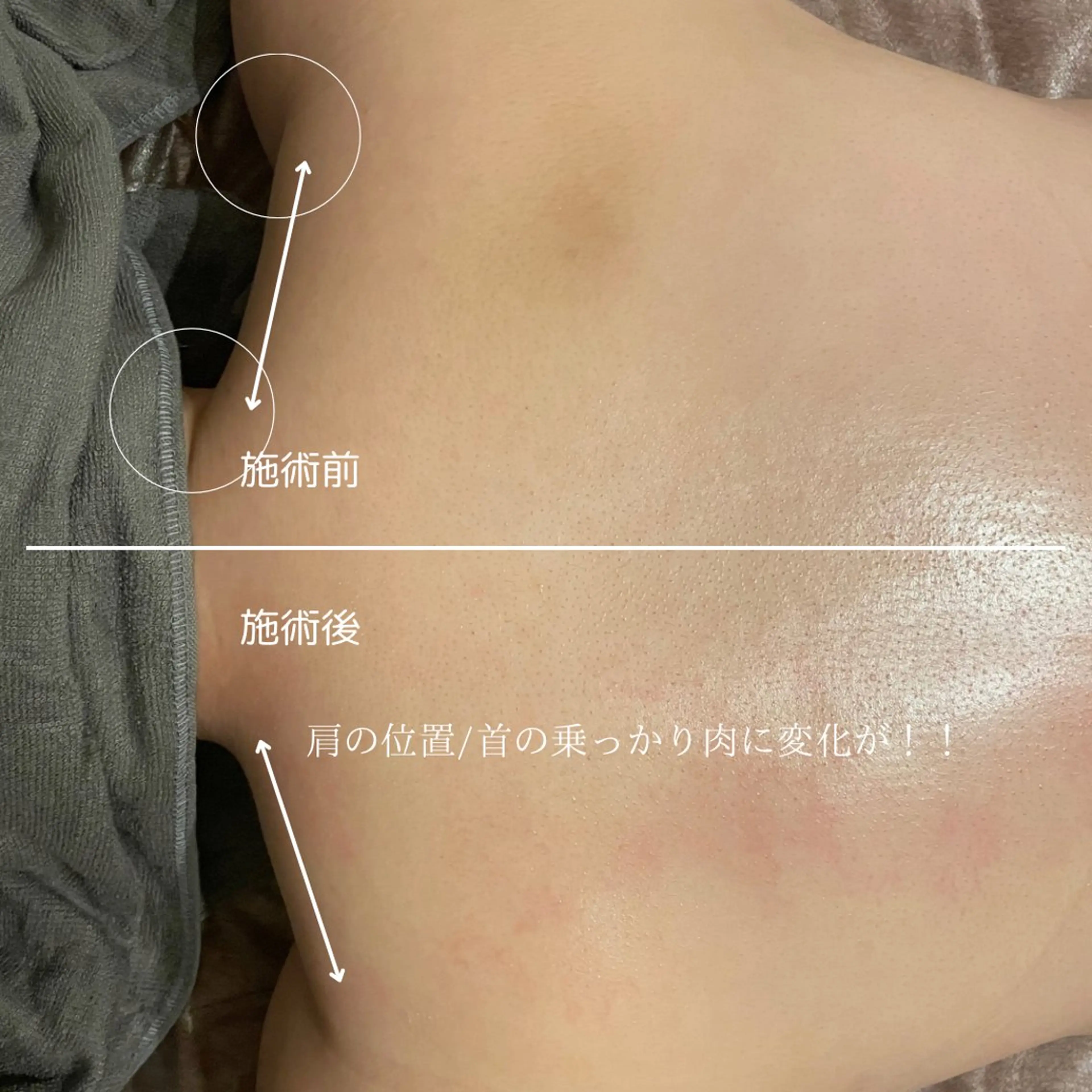 オフ:オン所属・オフ:オン 全身筋膜マッサージのエステ・リラクイメージ