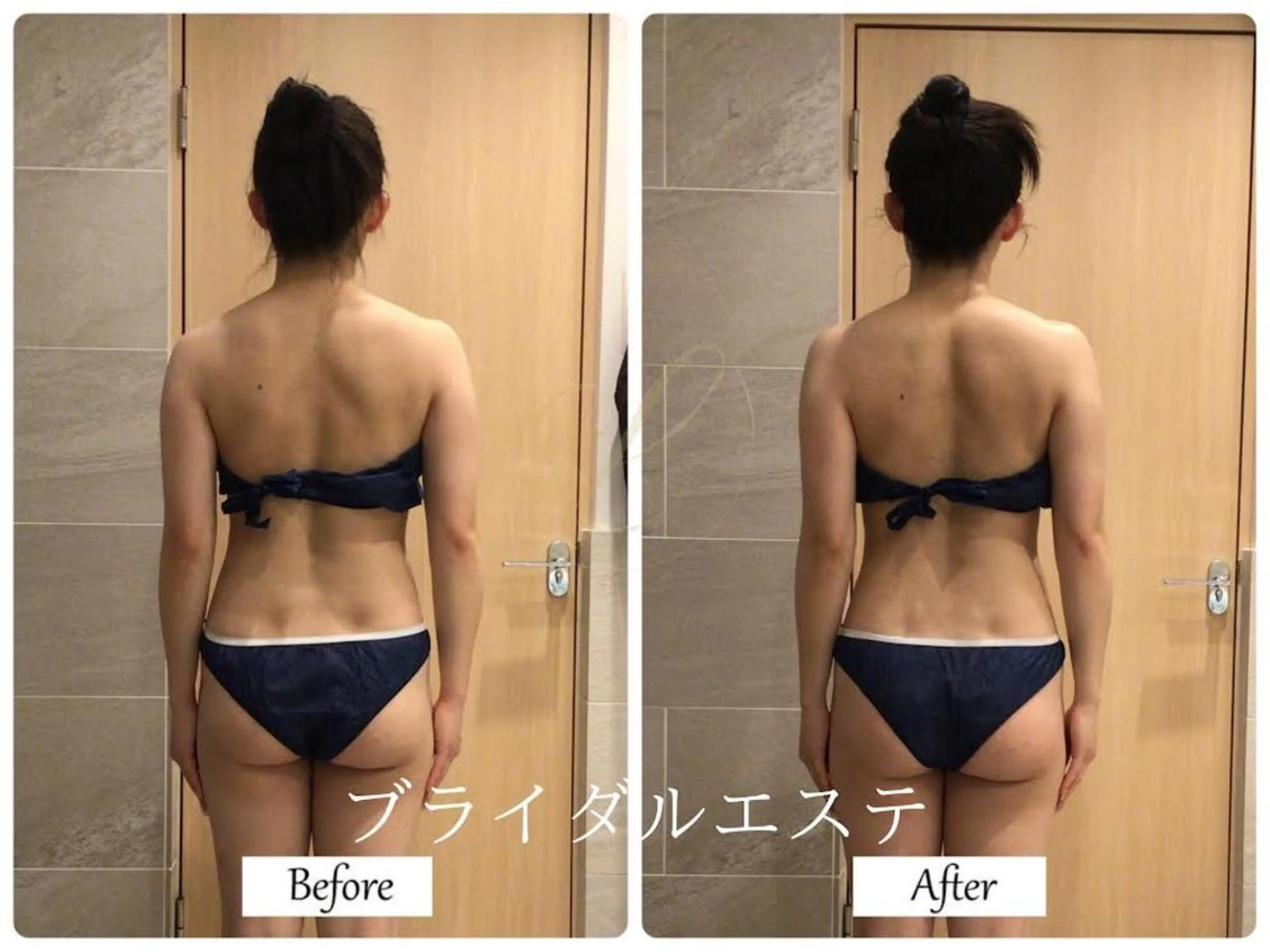 エステ リラク ブライダルサロン ｜Lino【堀江】のエステ・リラクイメージ