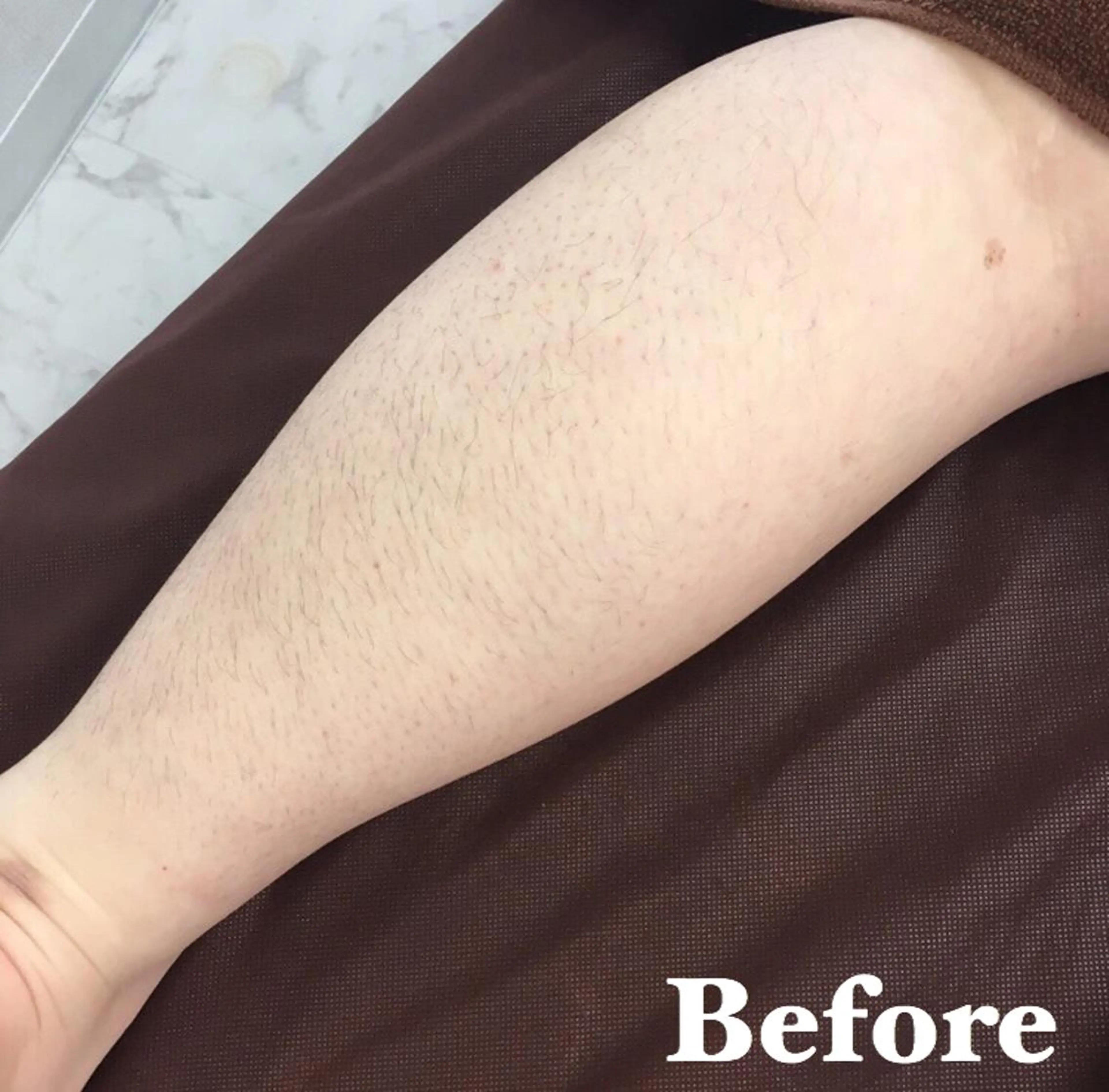 MIMI 吉祥寺本店のエステ・リラクイメージ