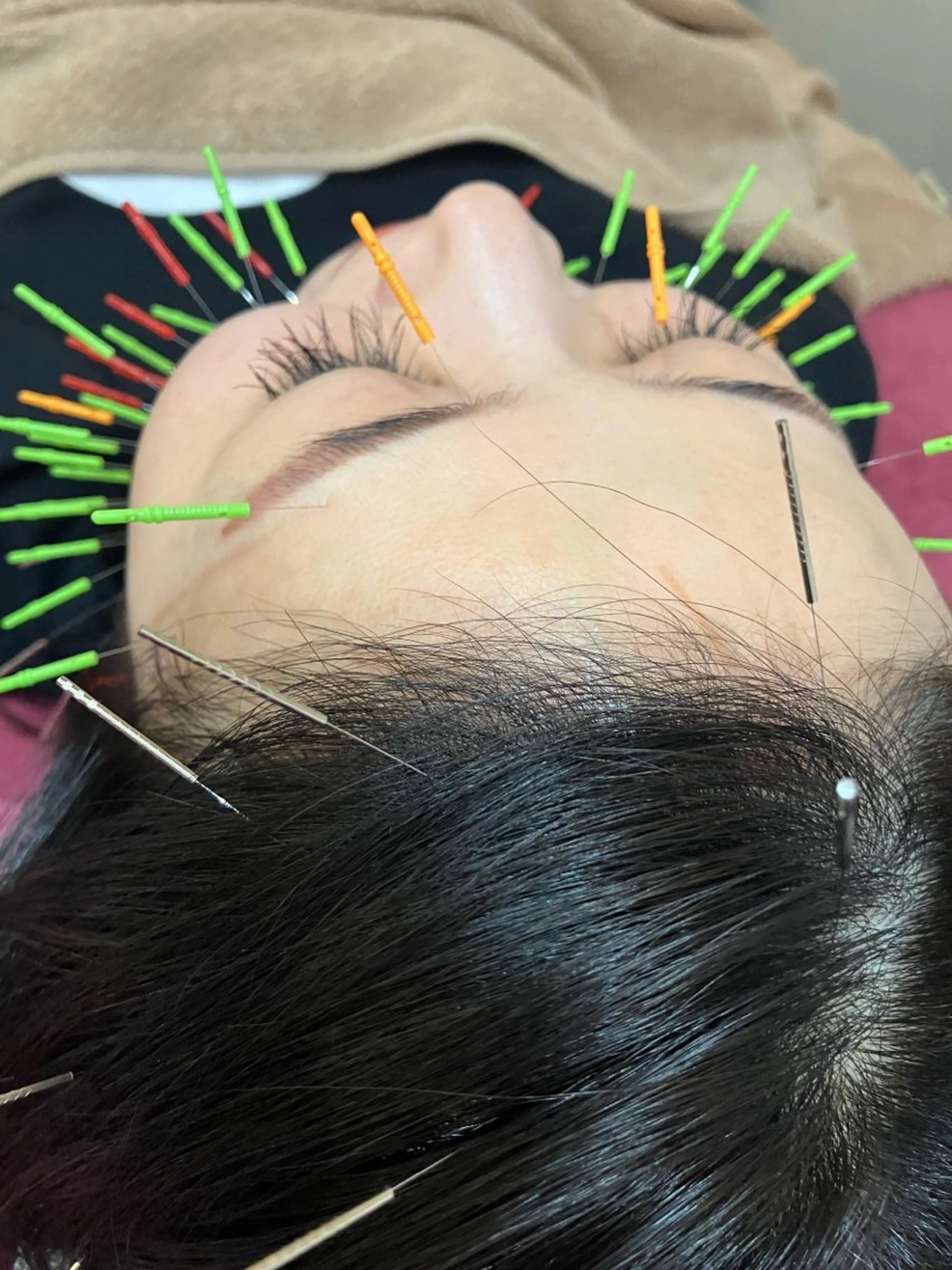 エステ リラク 美容鍼灸女性専用 りんご鍼灸治療院のエステ・リラクイメージ