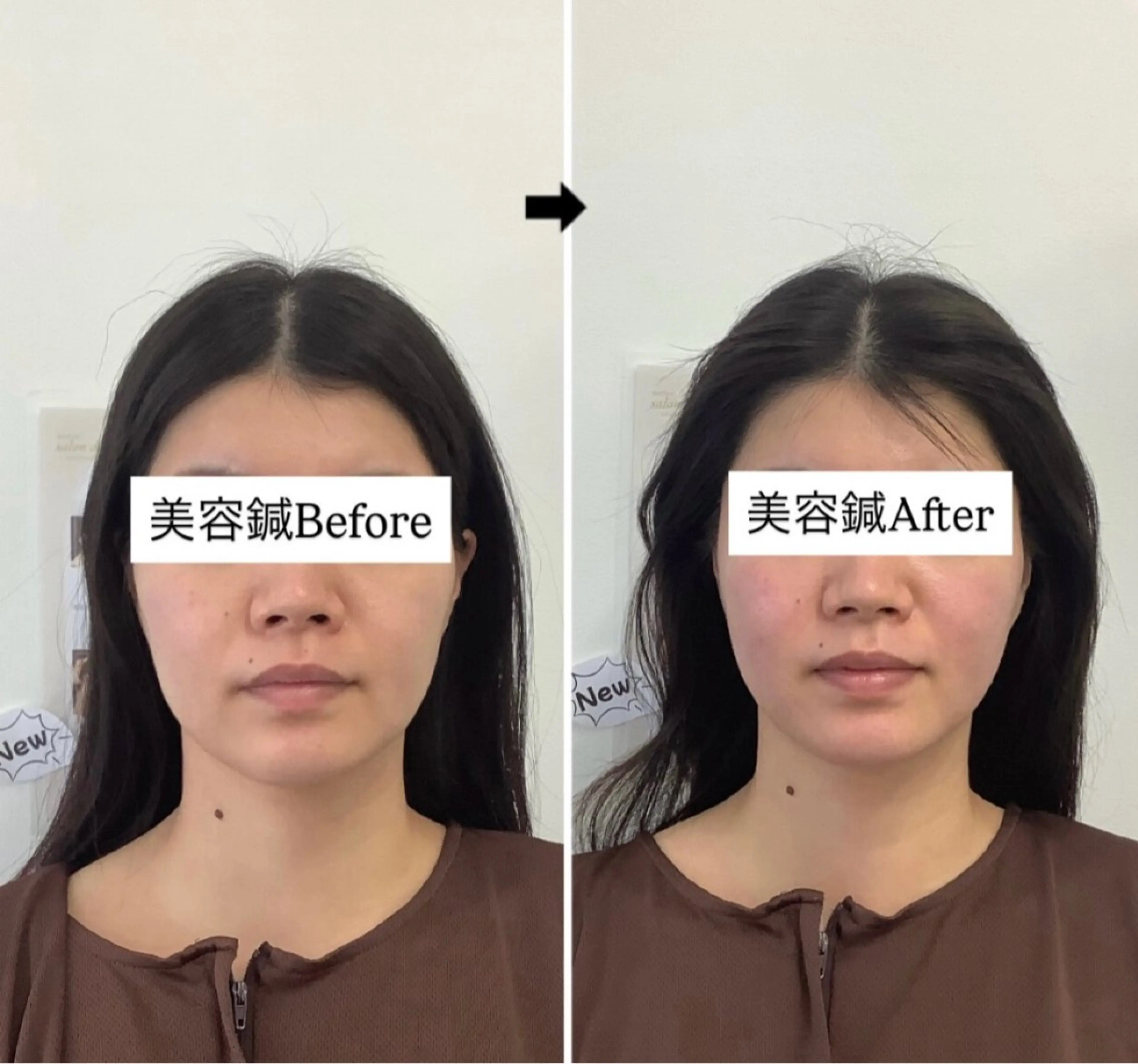 その他 hari salon de off　美容鍼灸×小顔整体【ハリサロンドオフ】所属・美容鍼灸×小顔整体♡ ハリサロンドオフ堺東のその他イメージ