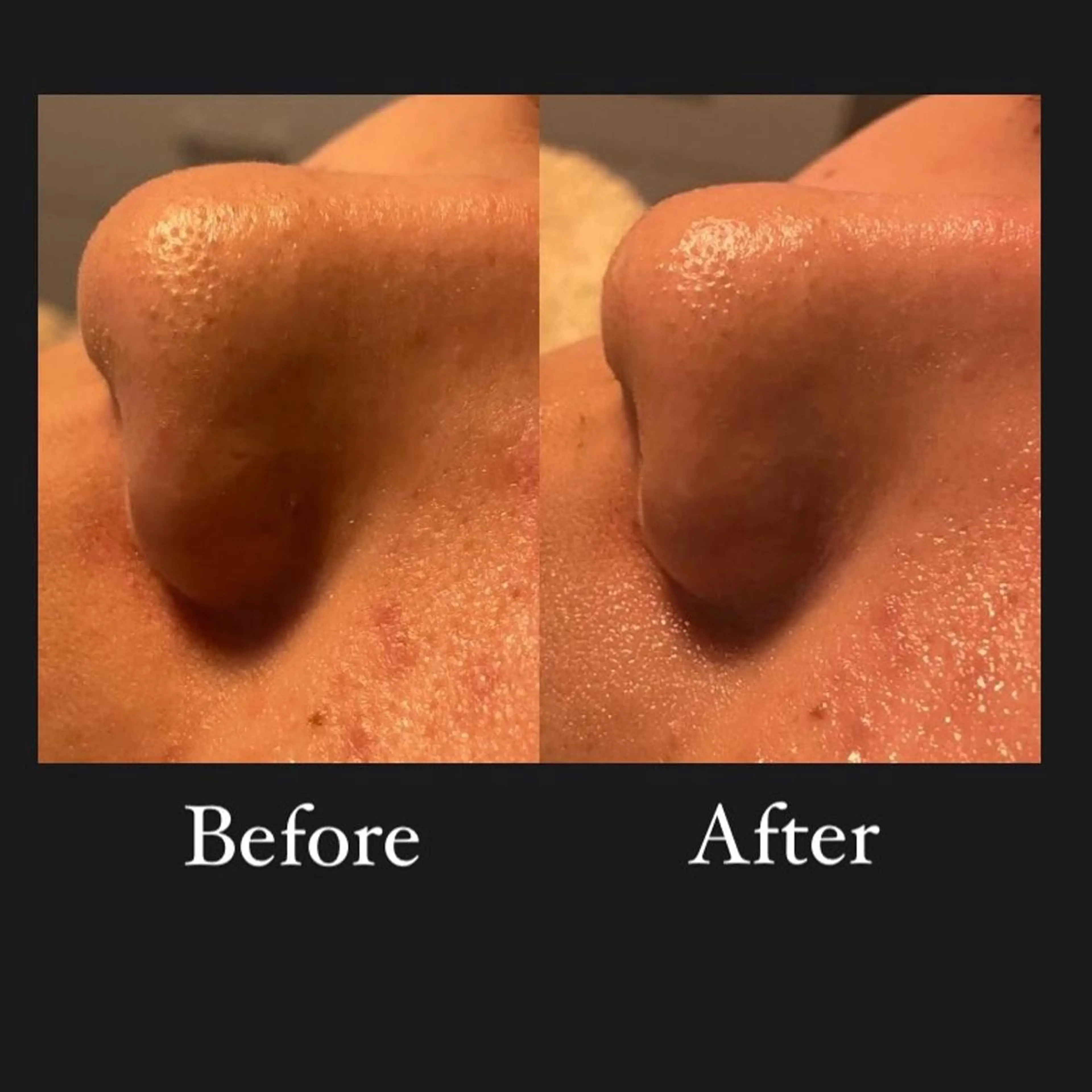 よもぎ蒸し専門店Artemisia所属・よもぎ蒸し専門店 Artemisiaのエステ・リラクイメージ