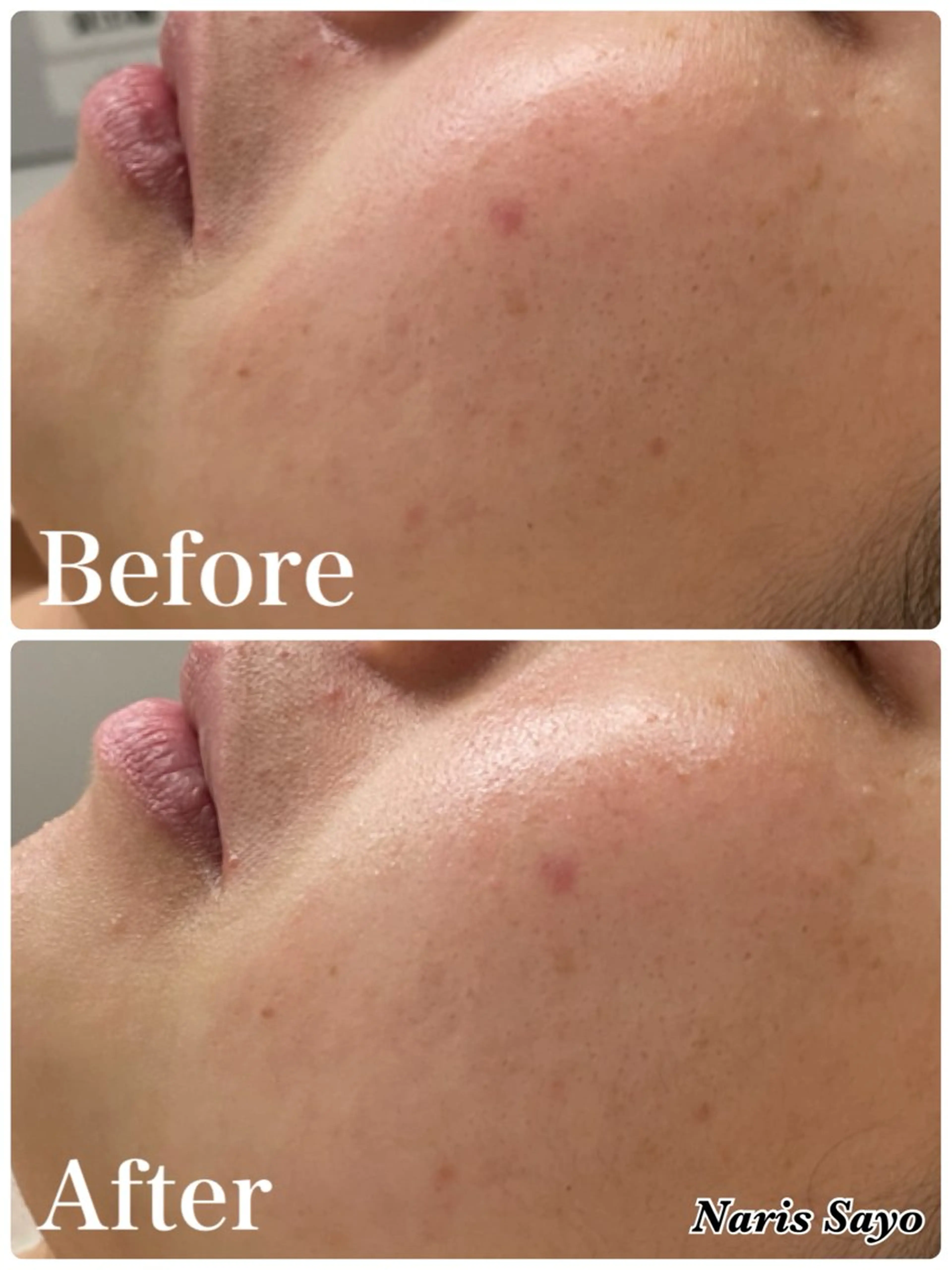 エステ デ・アイム豊中所属・朝山 紗世子のエステ・リラクイメージ