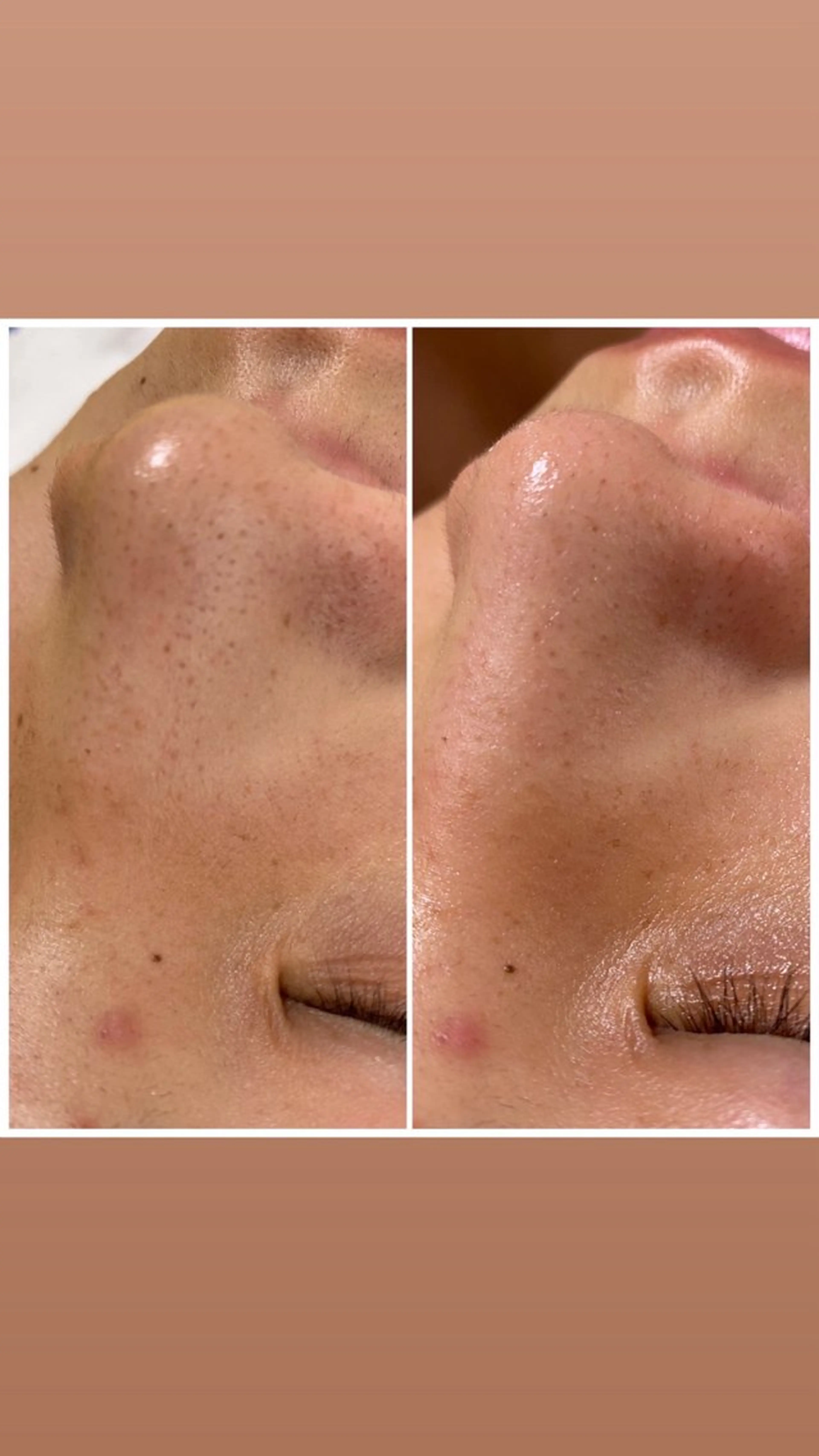 【頭痛、睡眠改善】 salon RUUのエステ・リラクイメージ