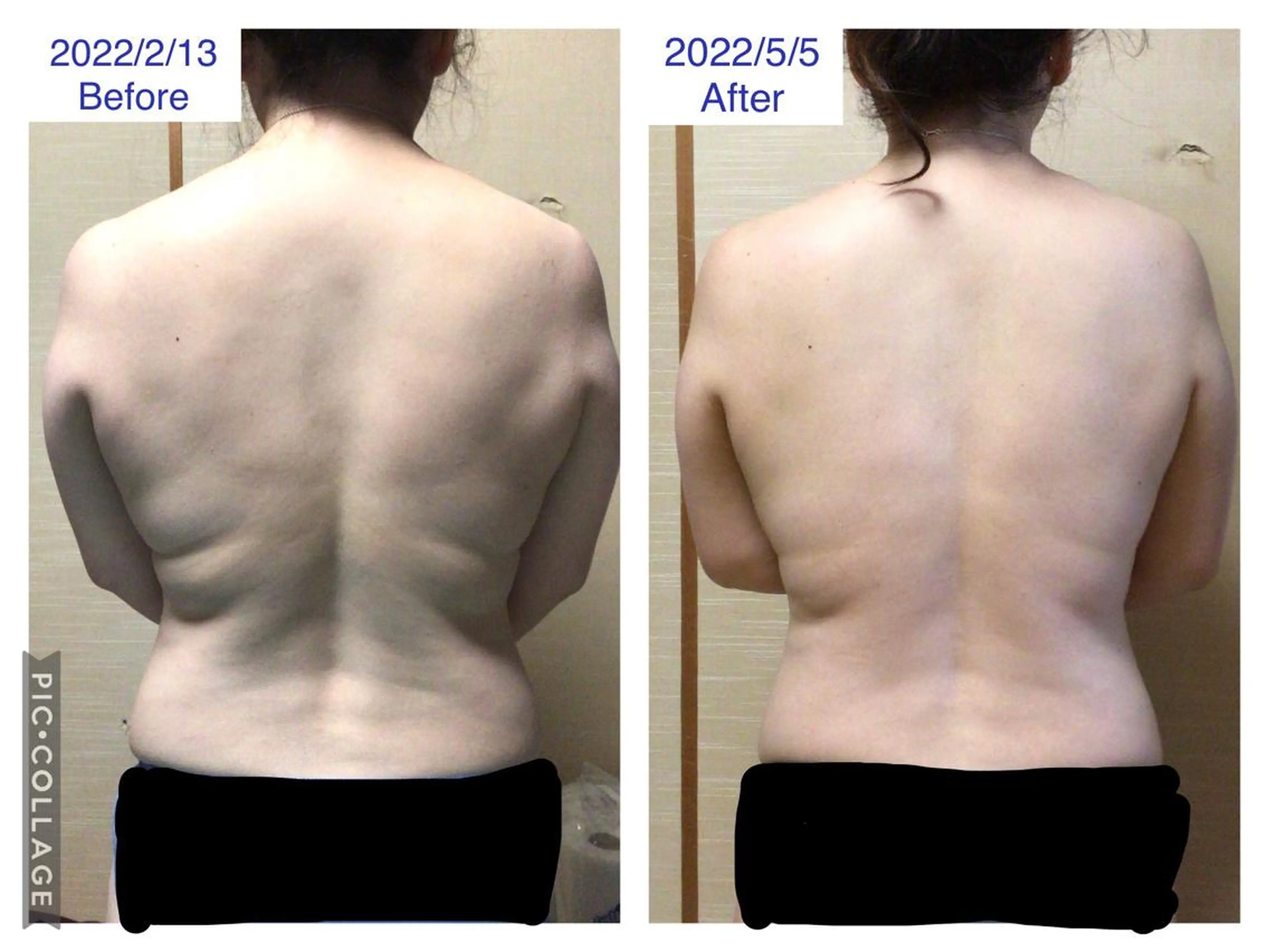 子宮矯正/腸揉み/ シュガーリング脱毛のエステ・リラクイメージ