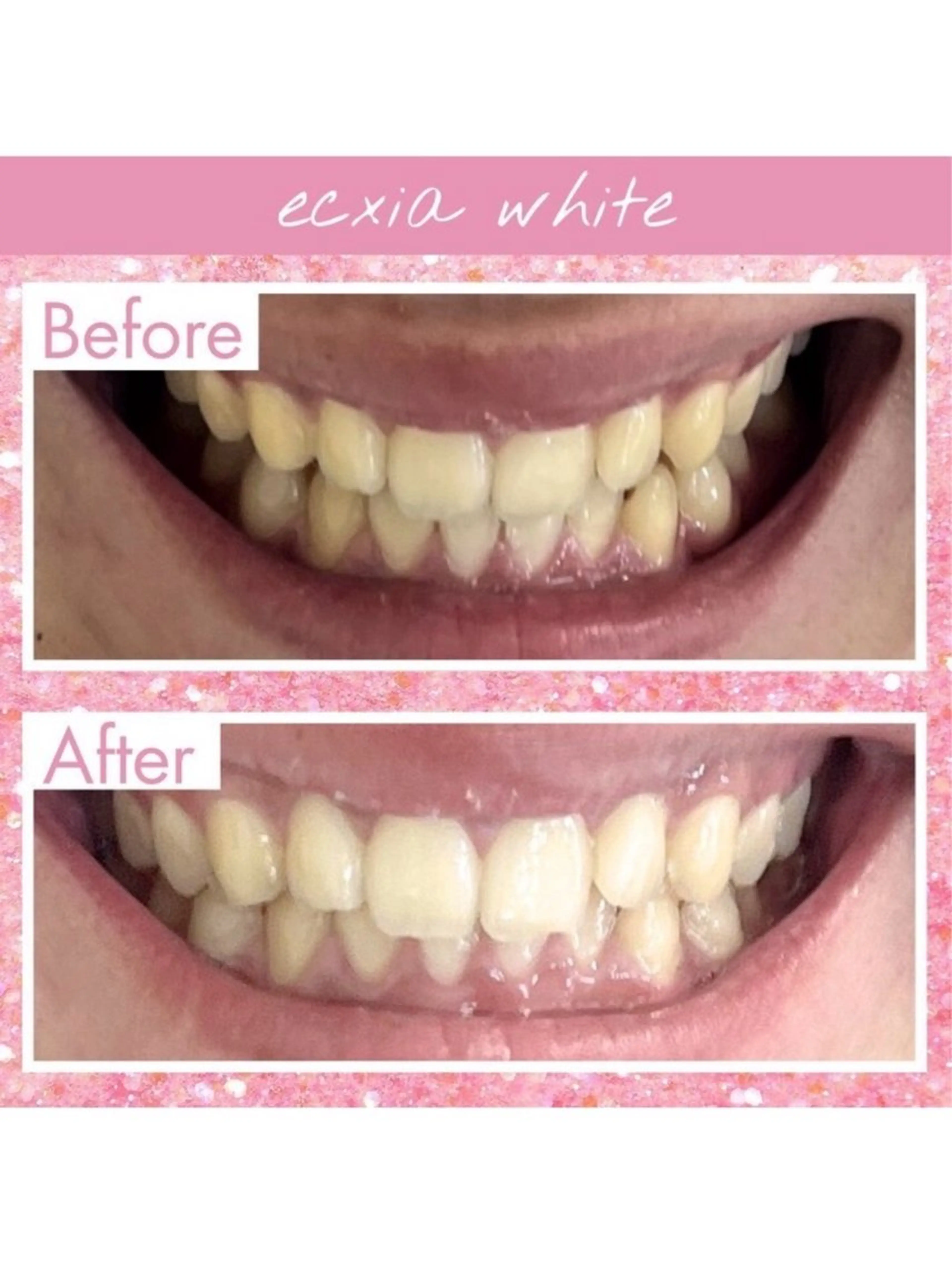 セルフホワイトニング エクシア武蔵小杉店のその他イメージ