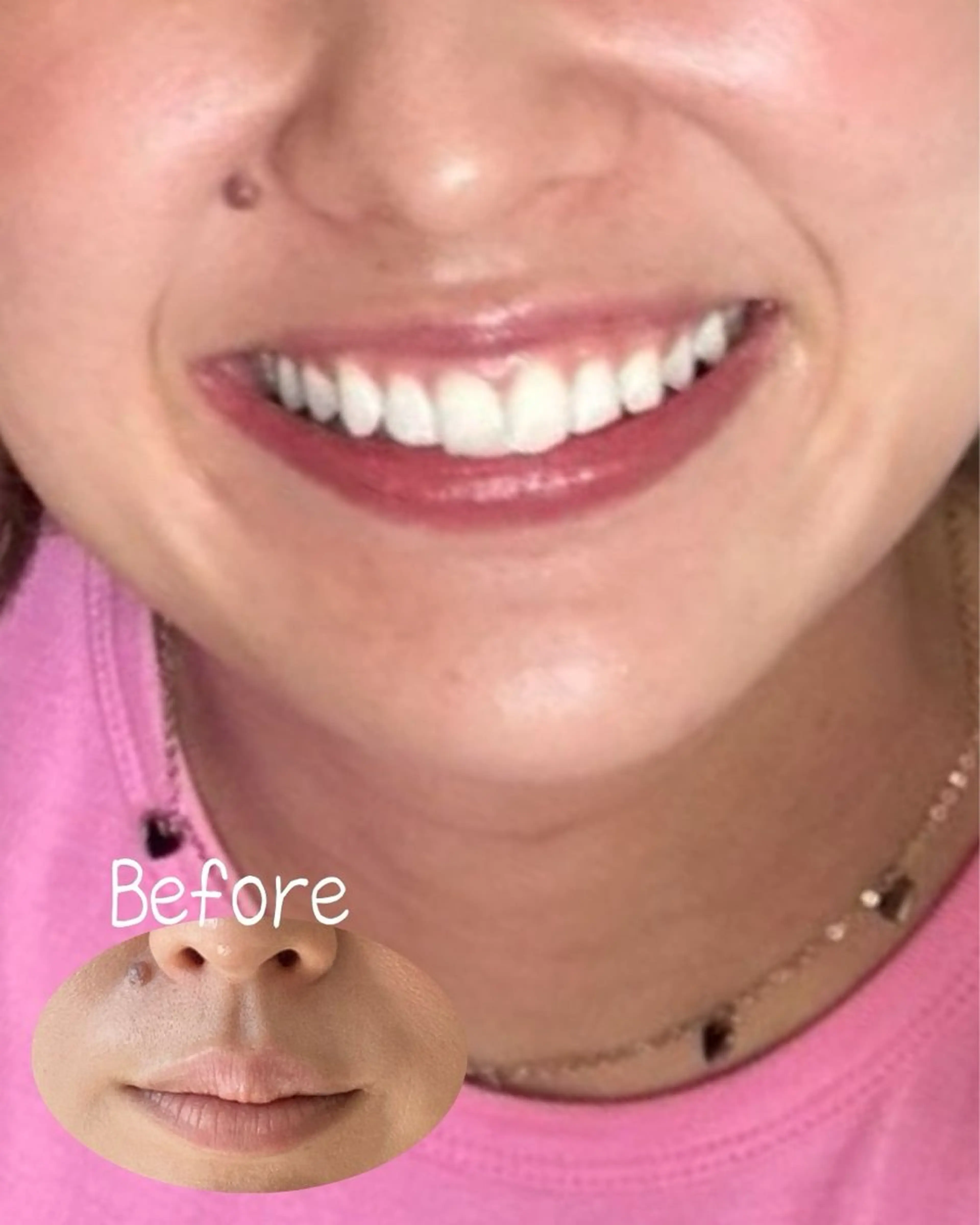 【すっぴんでも血色感を】🌸桜んぼリップカウンセリング＋ドライヘッドマッサージ30分／2,000円🌸の写真