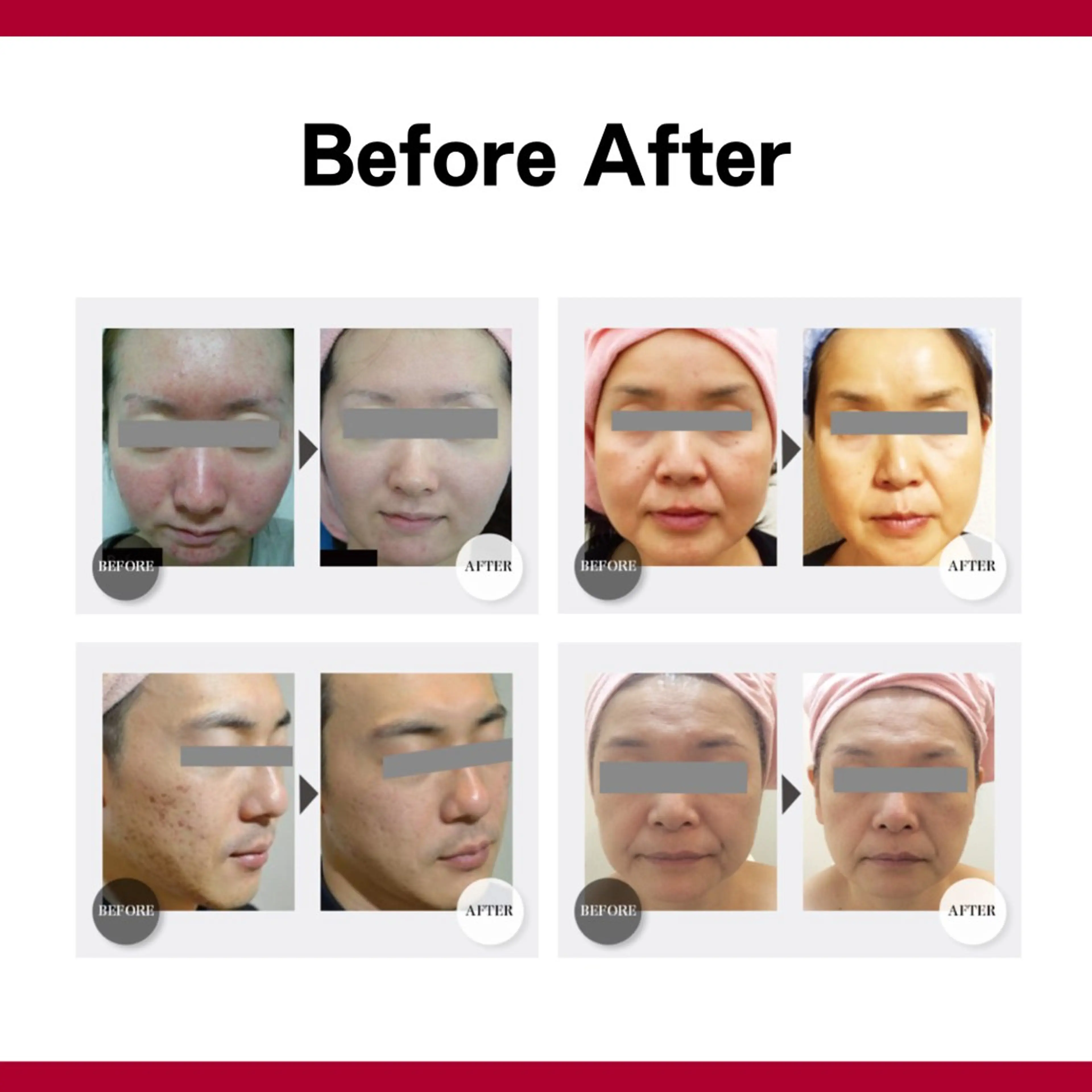 SHAPY HIGH SLIMMING ESTHETIC所属・嚴 キララのエステ・リラクイメージ