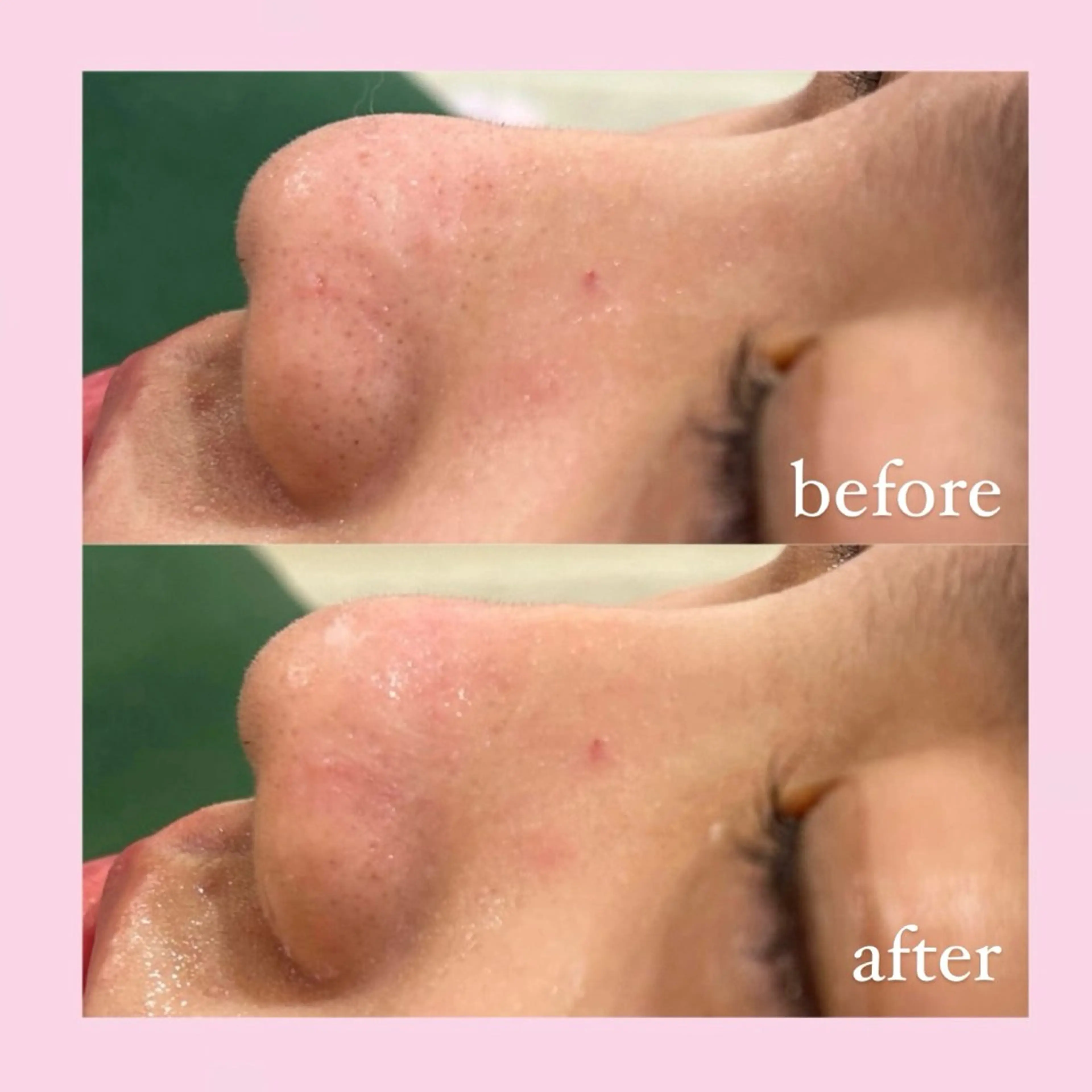 エステ 韓国肌管理専門店　White labo 宝塚店所属・有川 凜のエステ・リラクイメージ