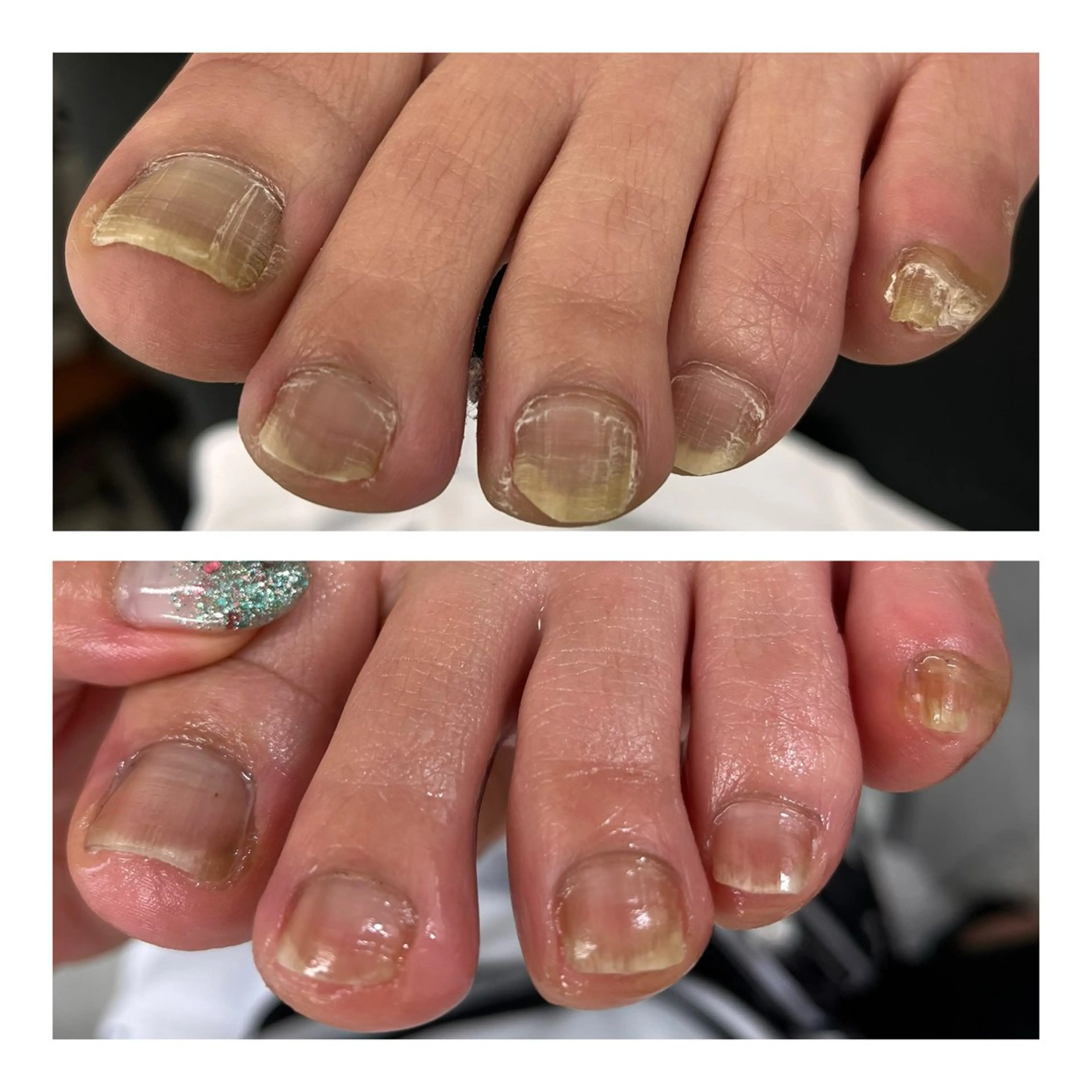 【フットトータルケア】足爪10本、足裏踵角質ケア、フットリフレの写真