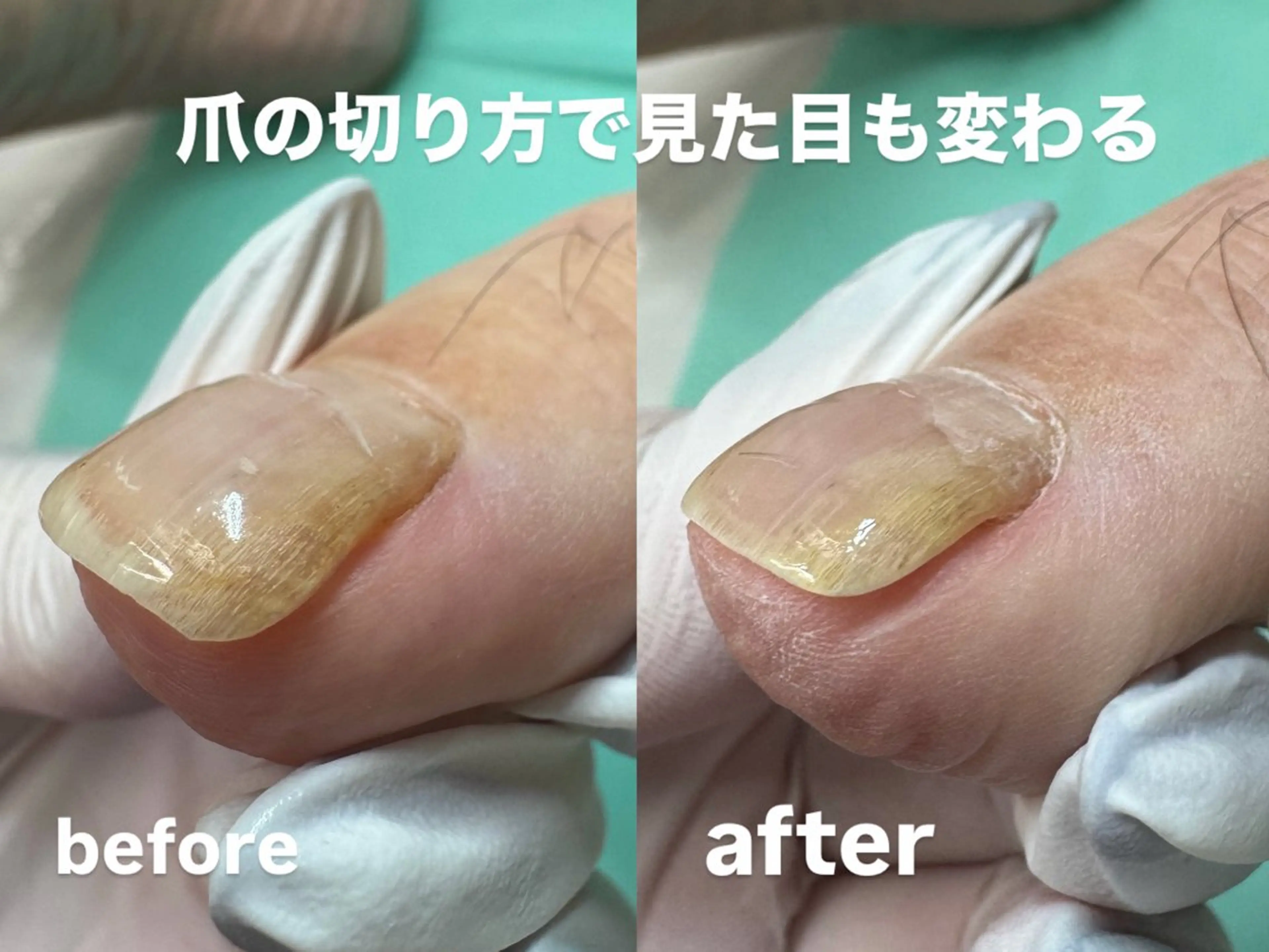 その他(ネイル) Lise footcareのネイルデザイン