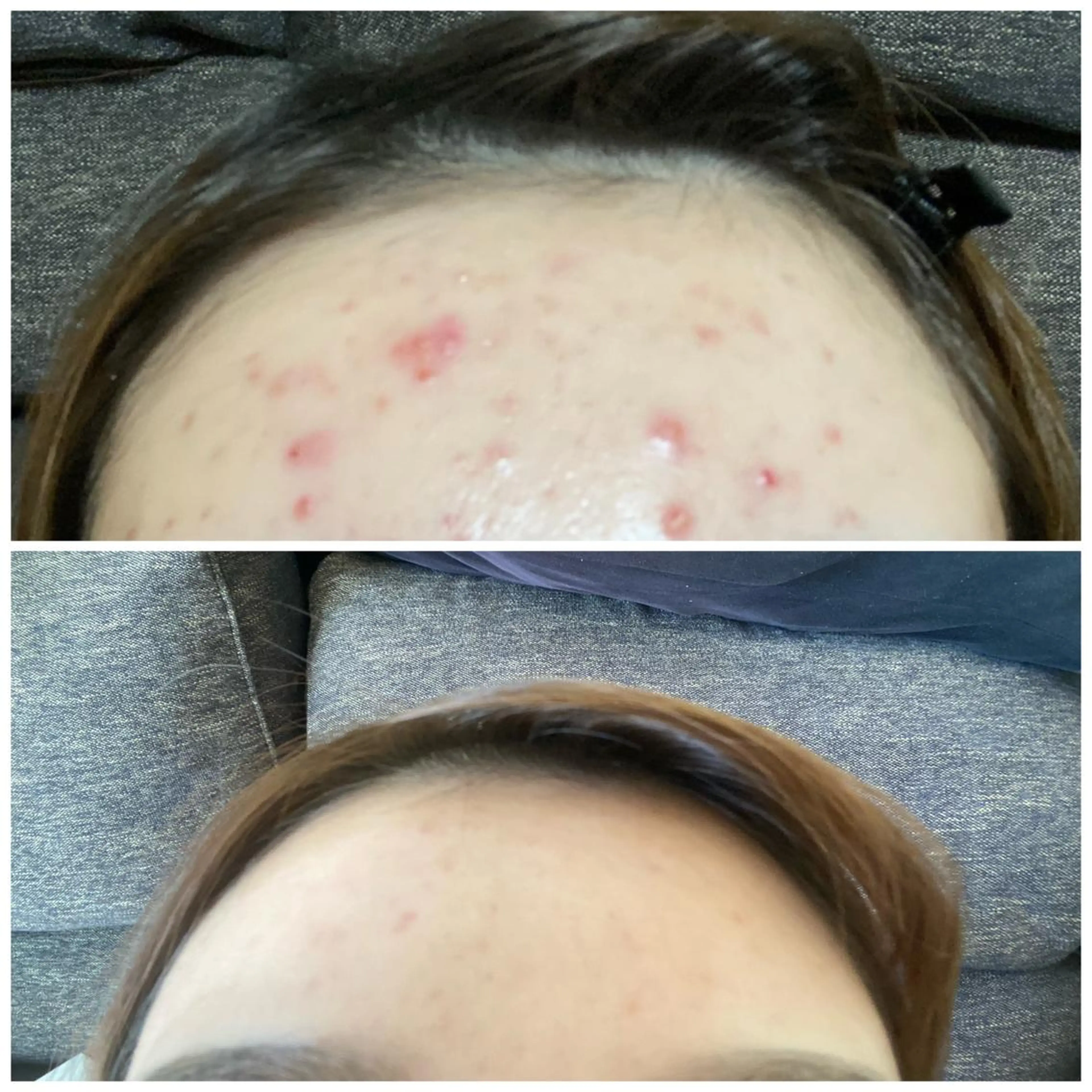 キッズ 美肌脱毛サロンGrande所属・別府脱毛サロン Grandeのエステ・リラクイメージ